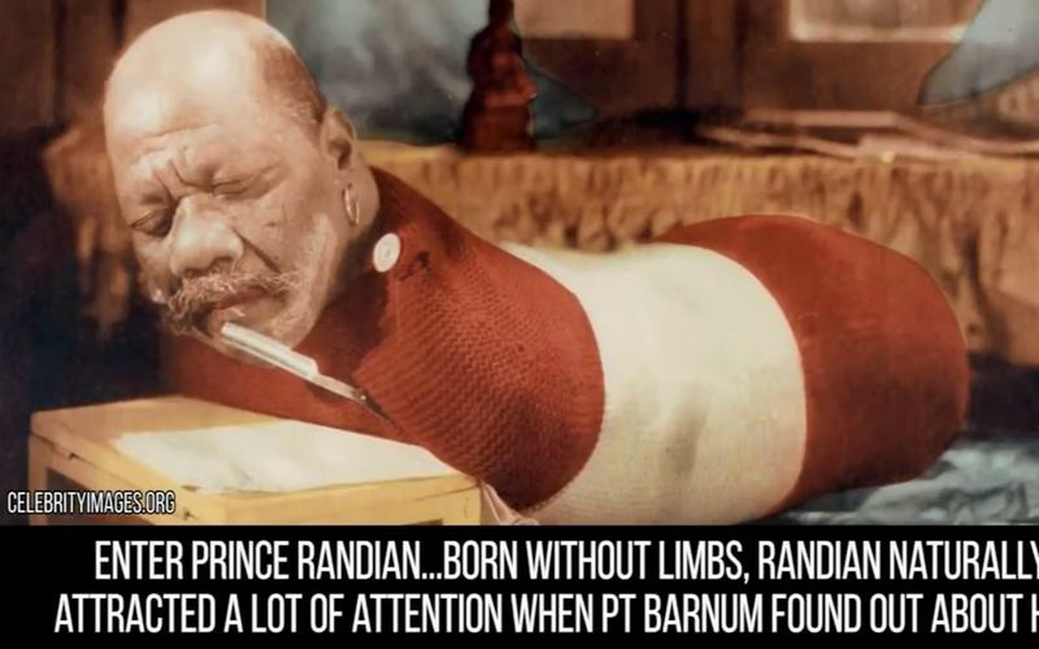 畸形秀国外一些重口味癖好群体和灰色产业,把人绑了四肢砍掉,就是砍断