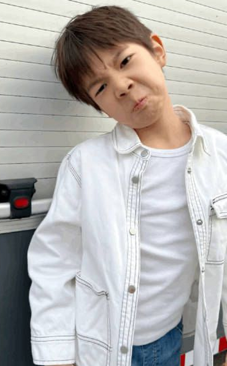 9岁的嗯哼嘴凸,他需要的不是矫正牙齿,而是口呼吸导致的腺样体面容.