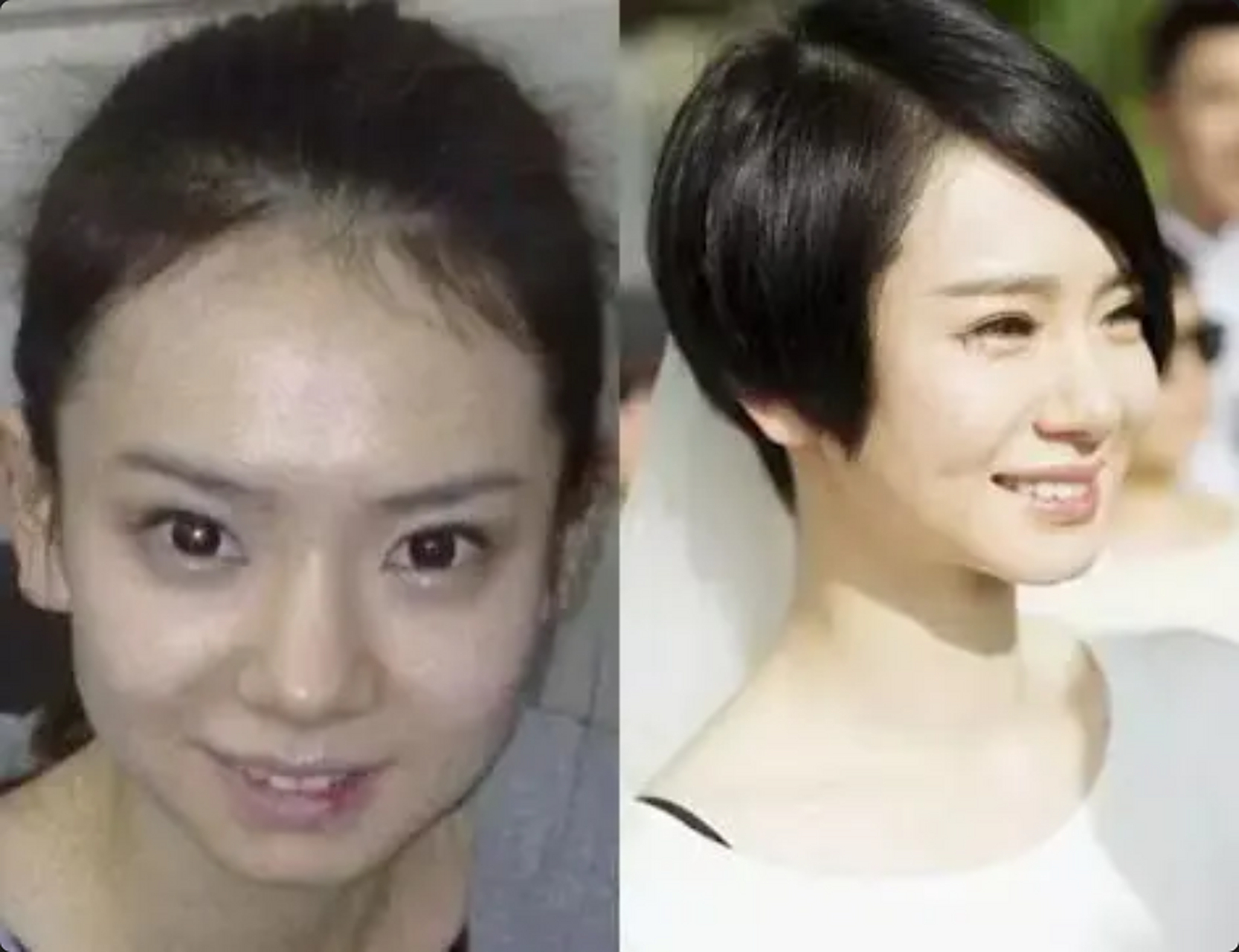 戚薇,戚薇挺大方的,承认割了双眼皮