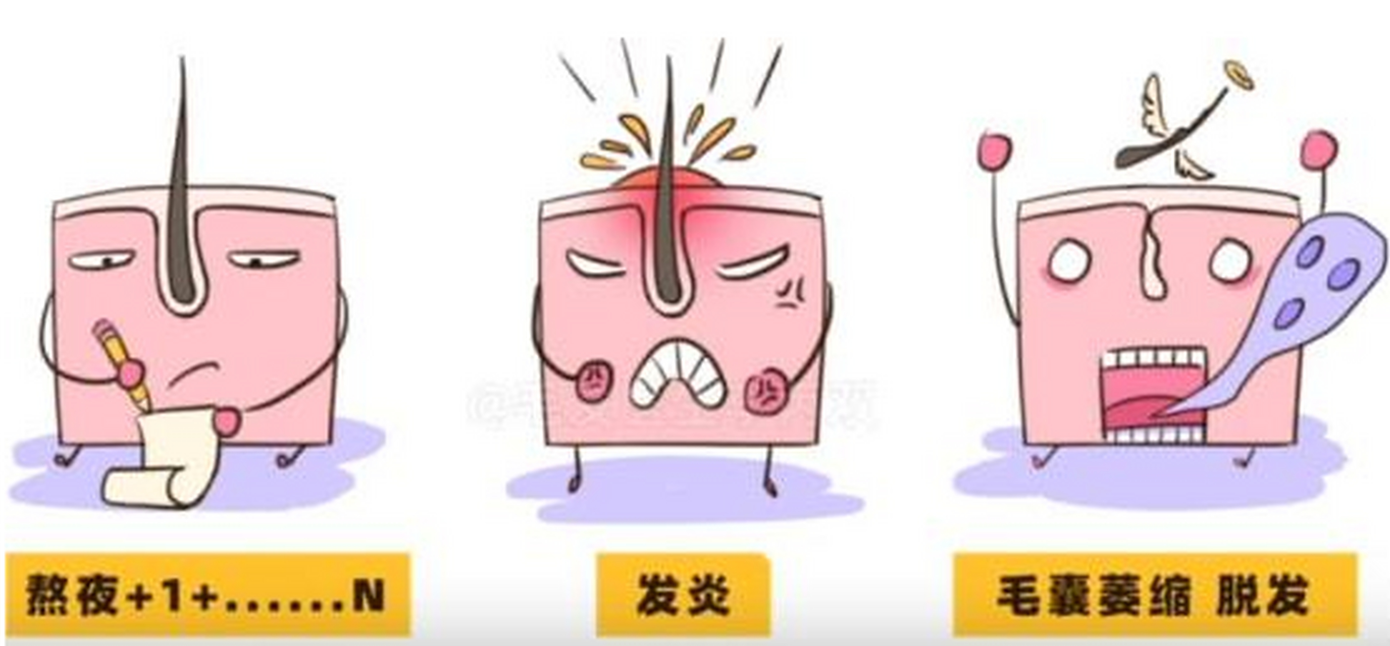 头皮#毛囊炎# ,主要是由于毛孔或毛发的牵拉,摩擦,搔抓引起的损伤