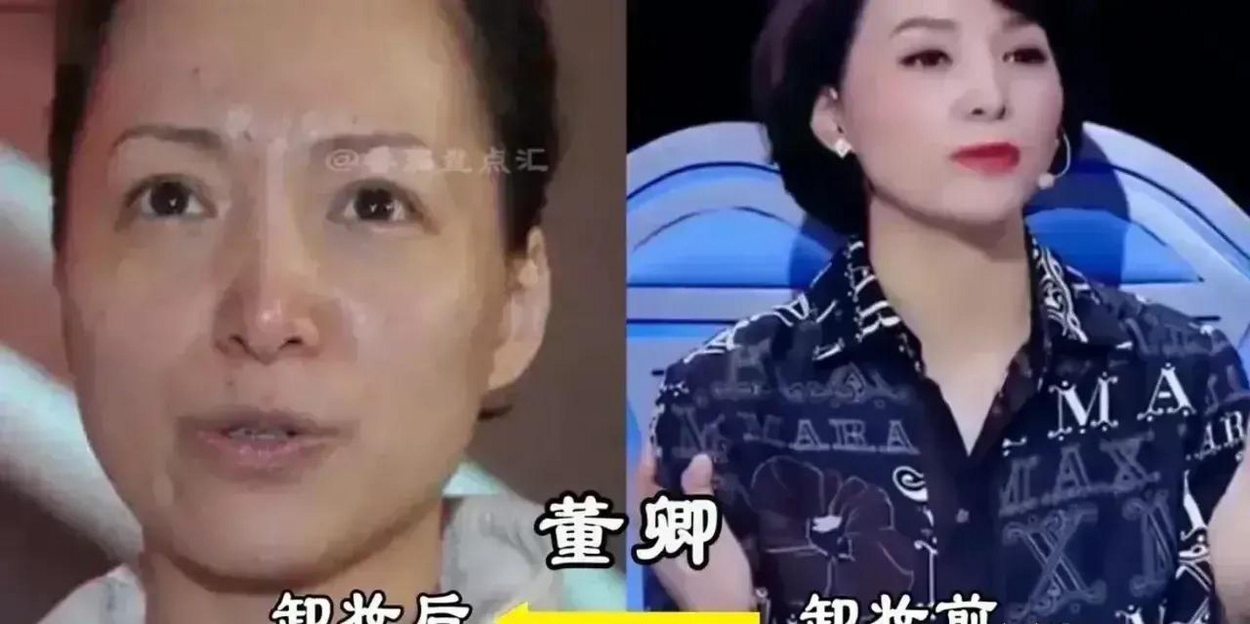 董卿卸妆前后对比照片图片