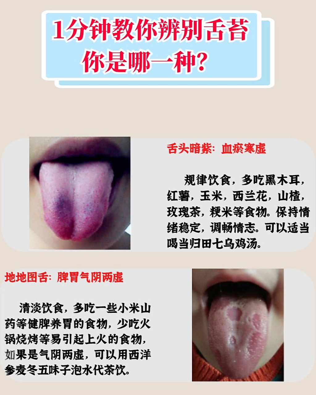 教你一分钟辨别舌苔,肝气郁结你是哪一种?#肝病# #肝气郁结# #肝