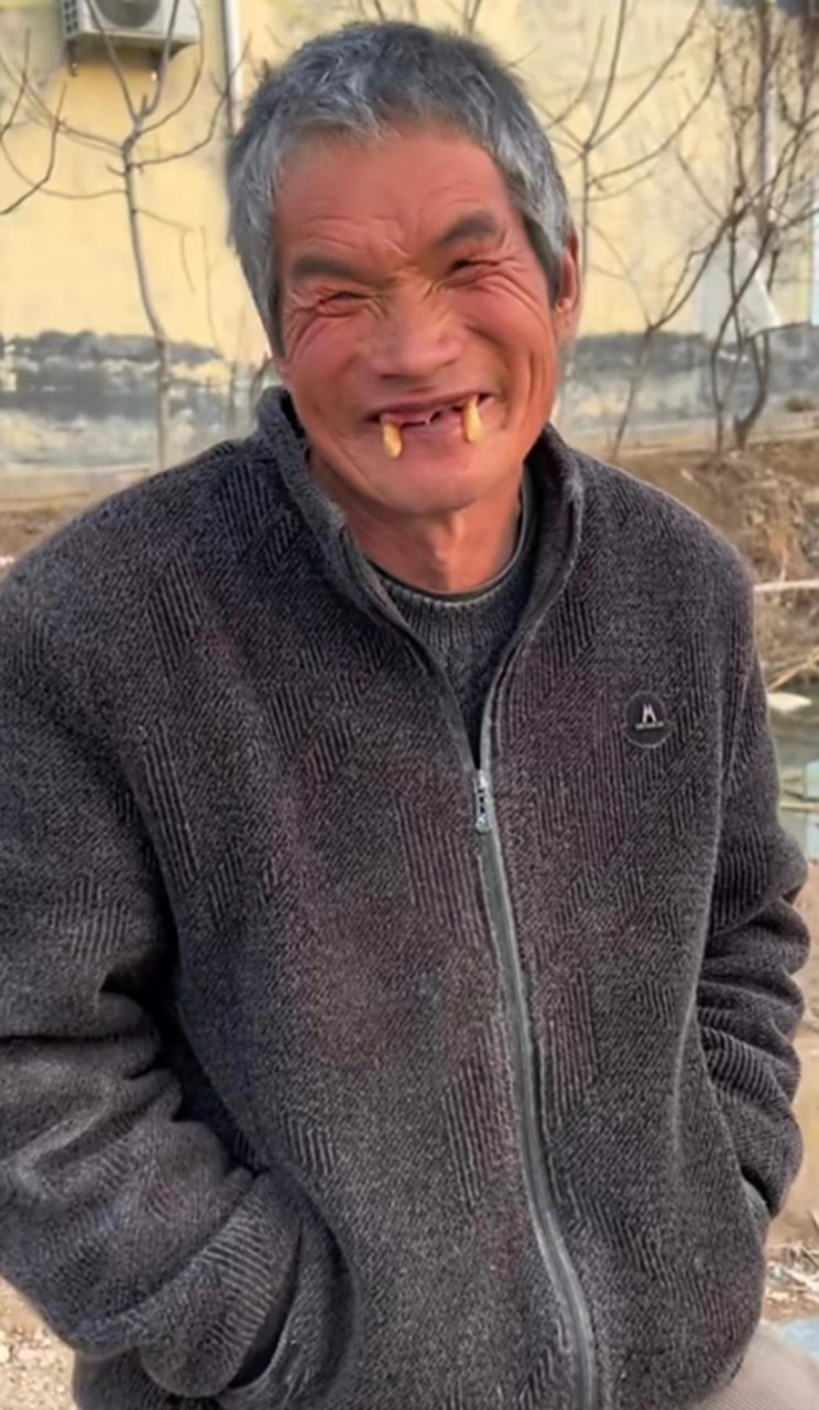 大爷,所有的牙都掉完了,唯独这两颗牙还那么坚挺着