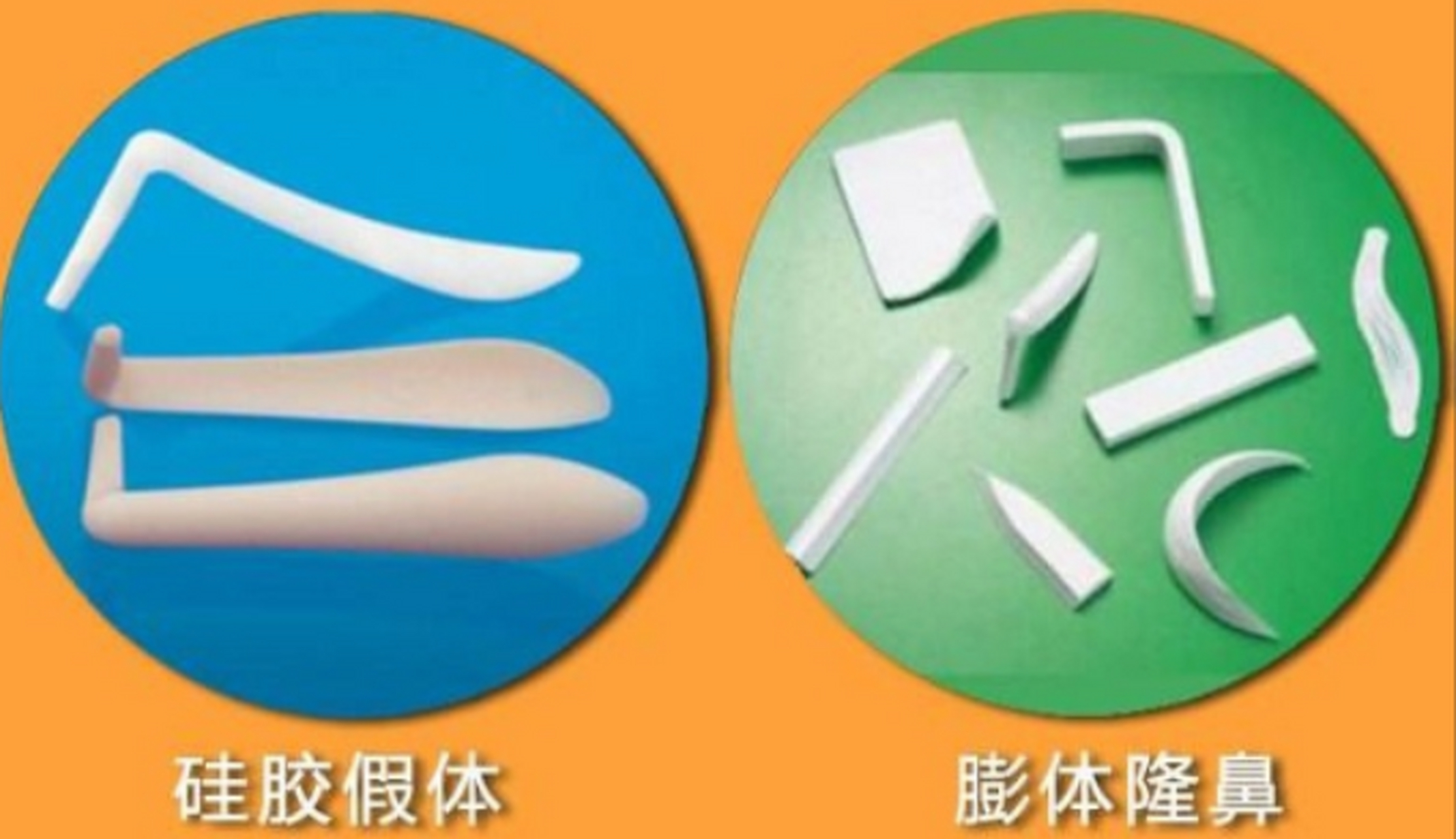 优缺点分析来了~ 假体隆鼻的材料分为硅胶和膨体,各有其优缺点: 1.