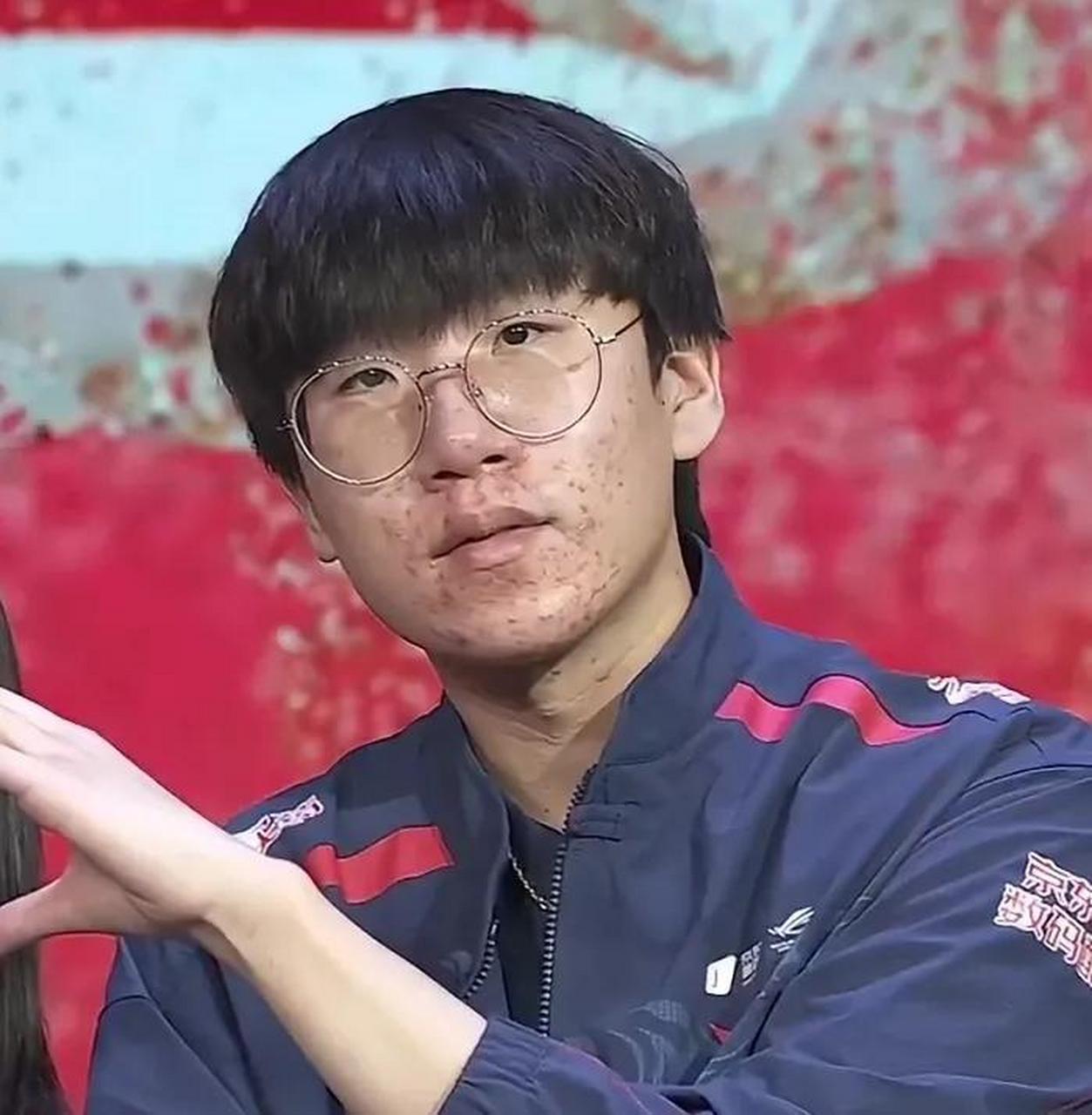 ruler来lpl后是被感染了么,这脸怎么比369还严重了?