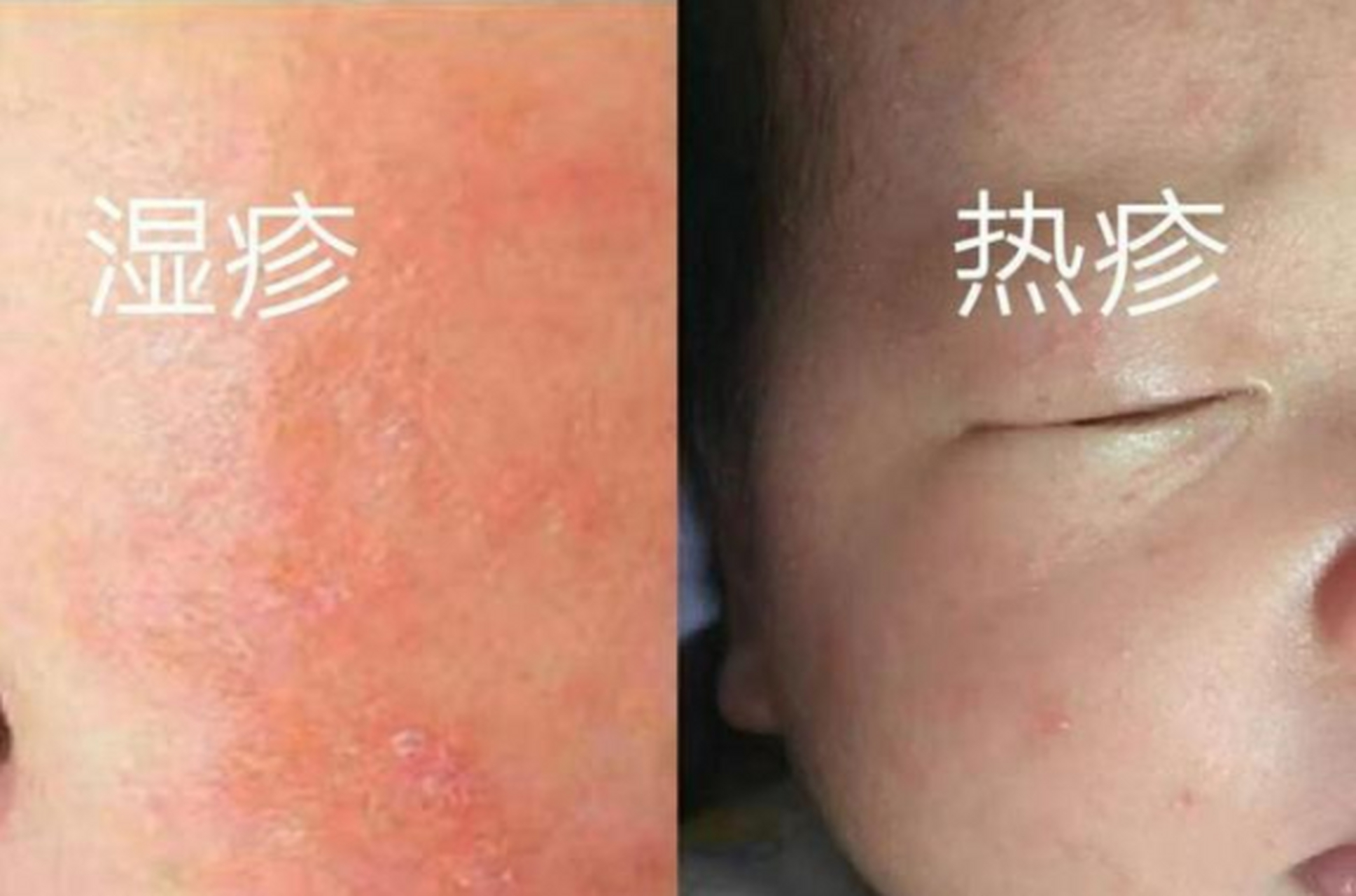 室外20来度的气温,一岁多的孩