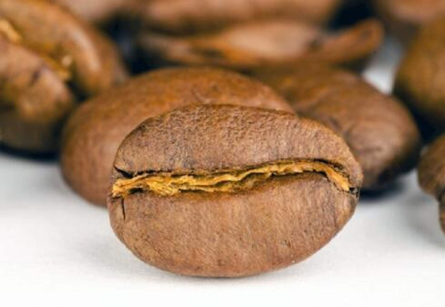 咖啡豆征——乙状结肠扭转的典型影像学表现