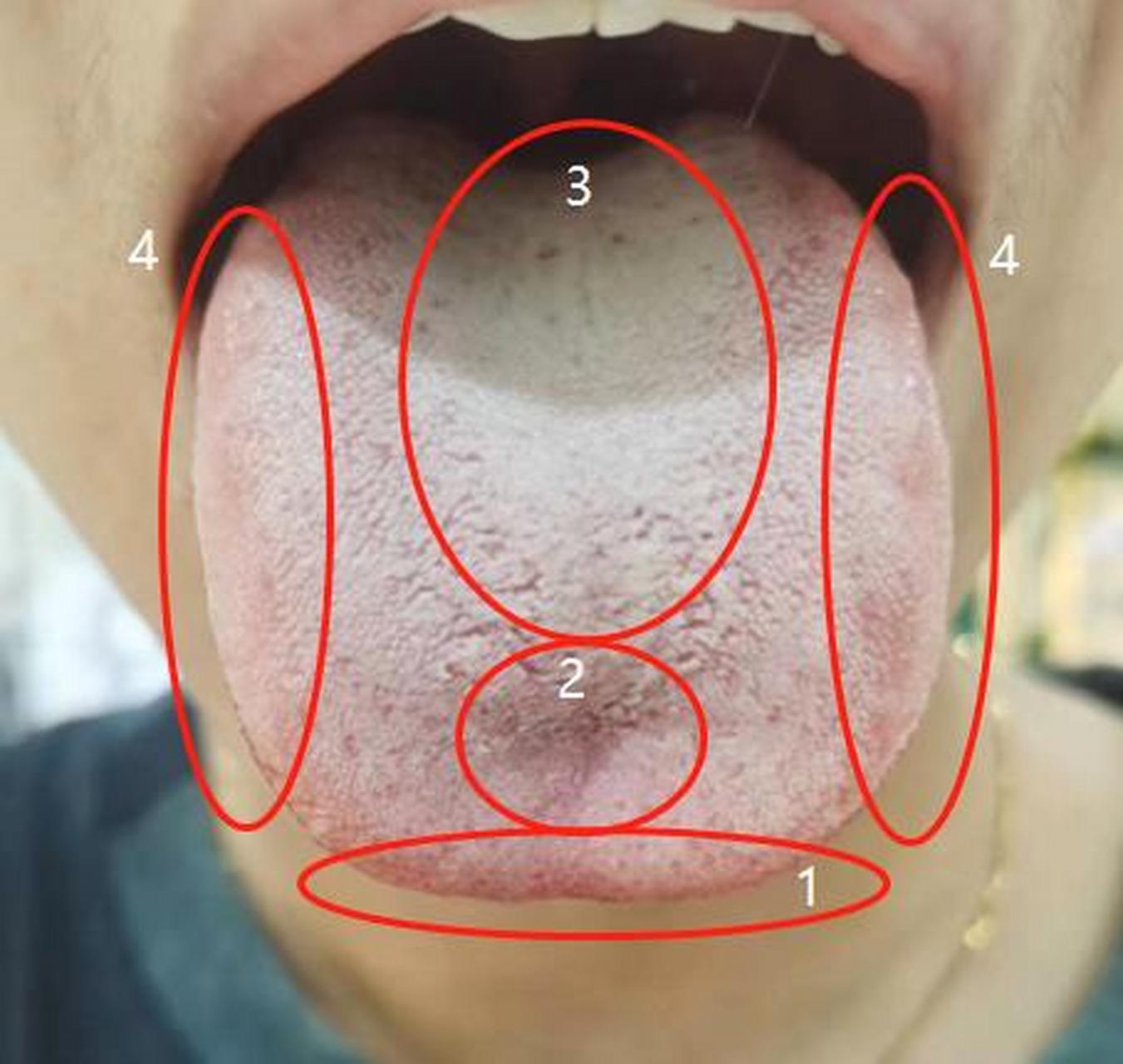 昨天遇到一位女士朋友,气血不足,下焦湿盛,阳虚[并不简单][并不简单]