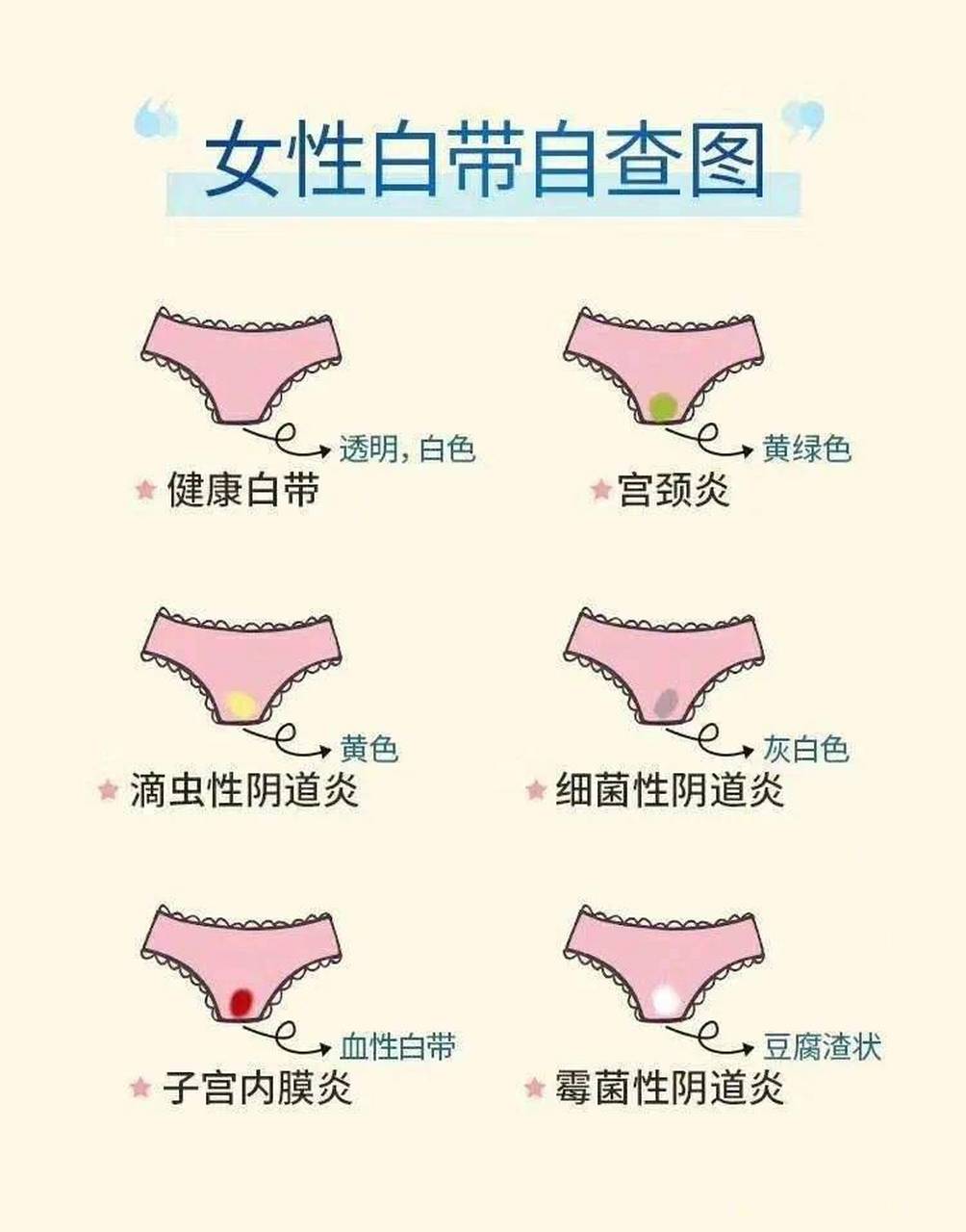 正常白带颜色是乳白或者透明,质地清晰粘稠无味.