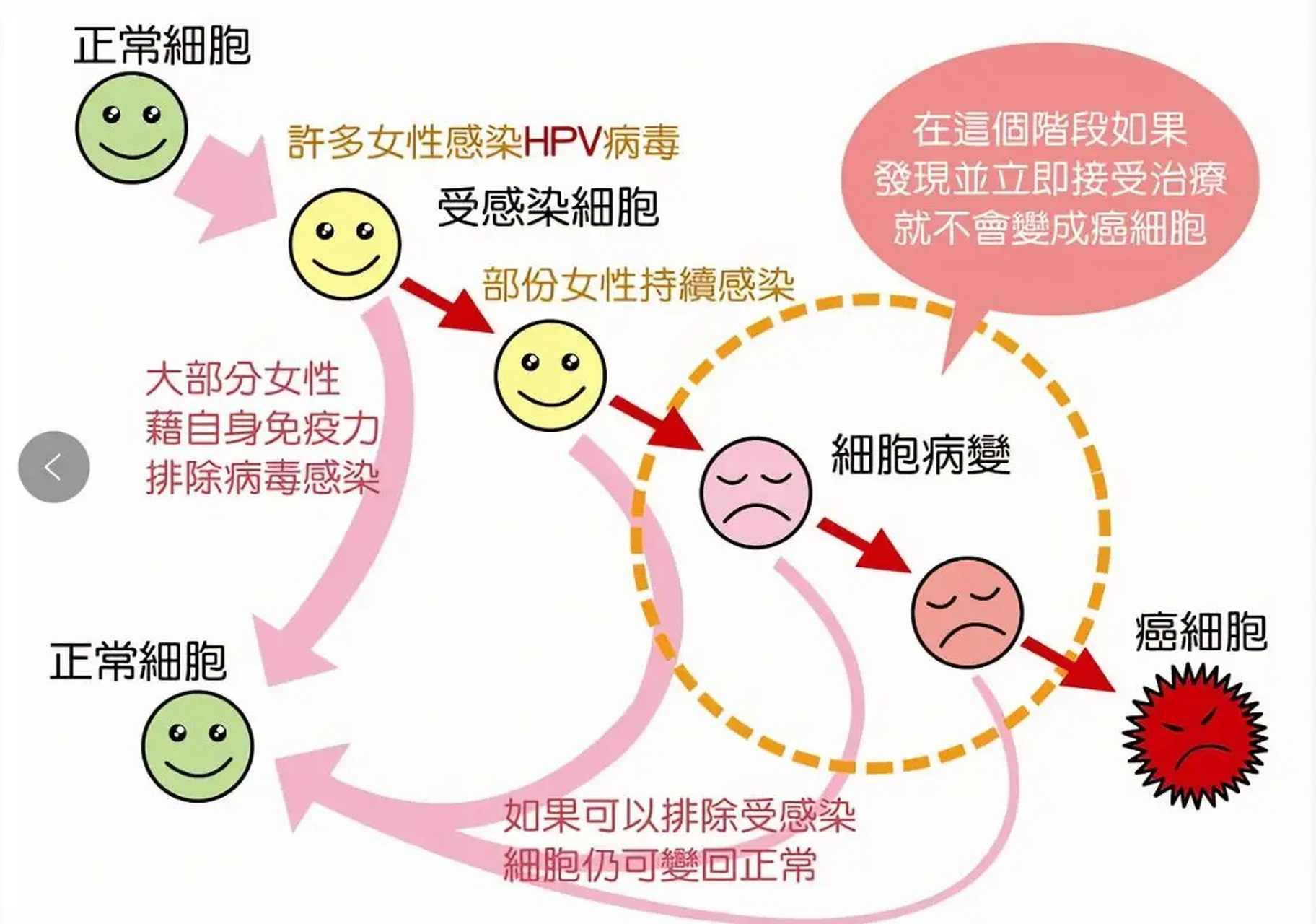 从hpv感染到发展成宫颈癌,需要多长时间?