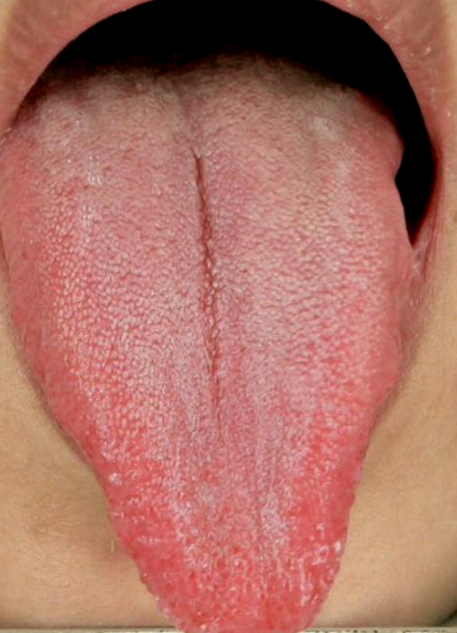 "医生,我觉得我的舌头好长啊,舌头好尖,我照镜子的时候都觉得自己的