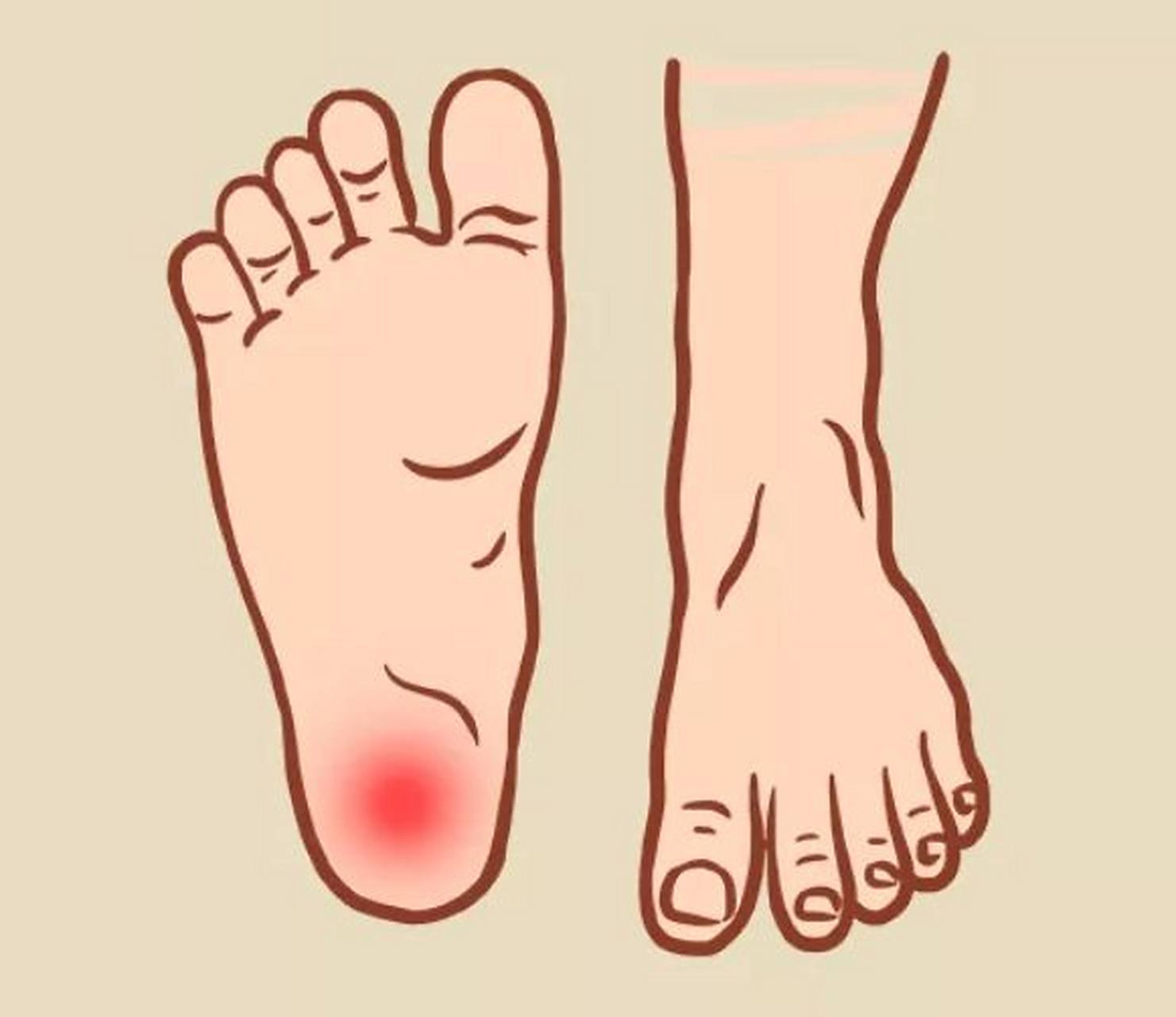 我们的脚底有一片贯穿足底的软组织,起源于根骨