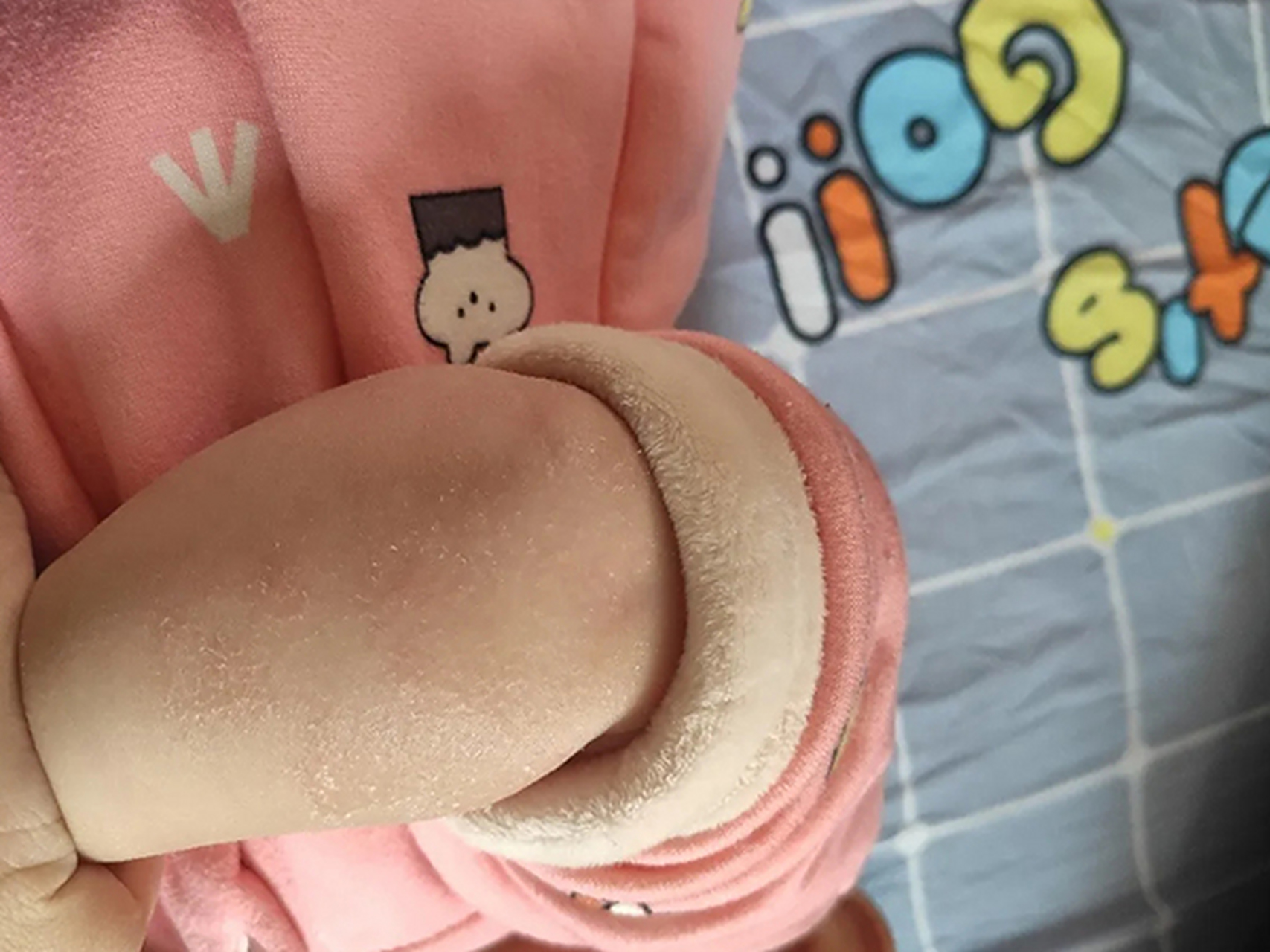 宝宝干性湿疹一般主要表现是皮肤潮红,干燥,有细小的糠秕状鳞屑.