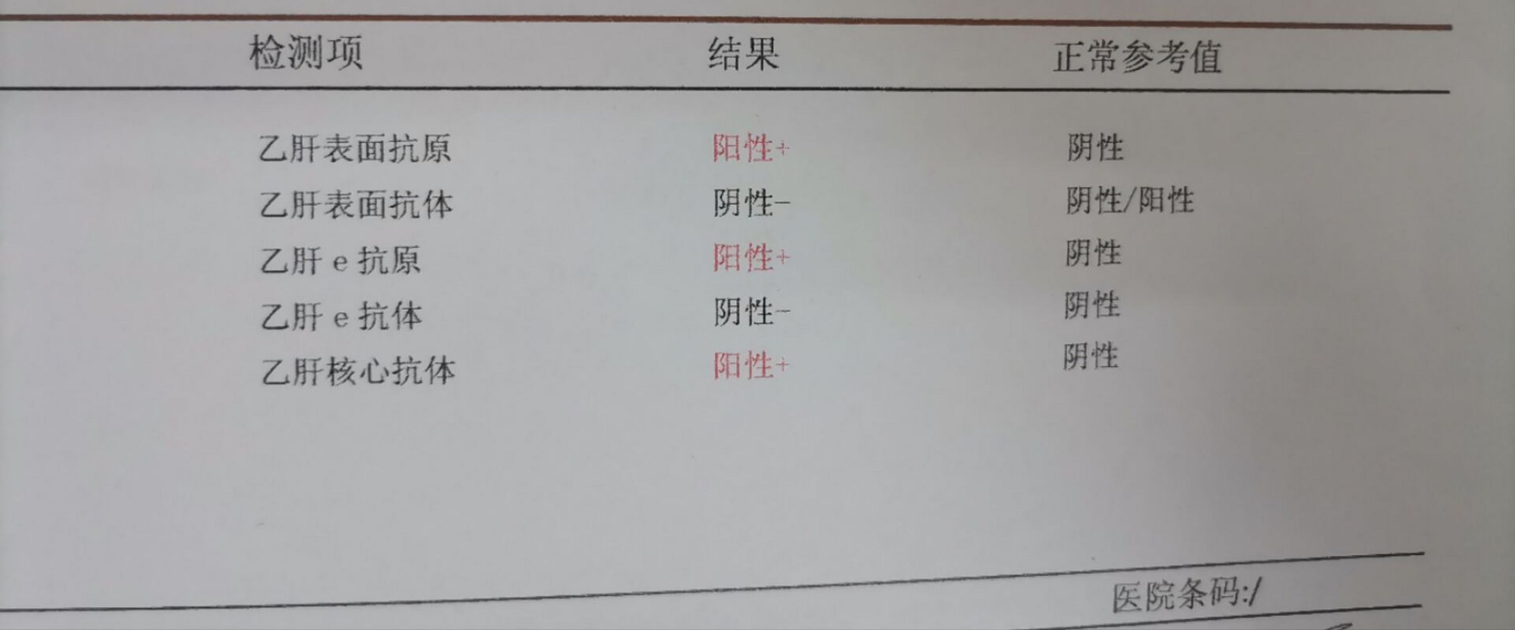 乙肝五项全面解读 乙肝表面抗原(hbsag):乙肝病毒(hbv)感染最重要的