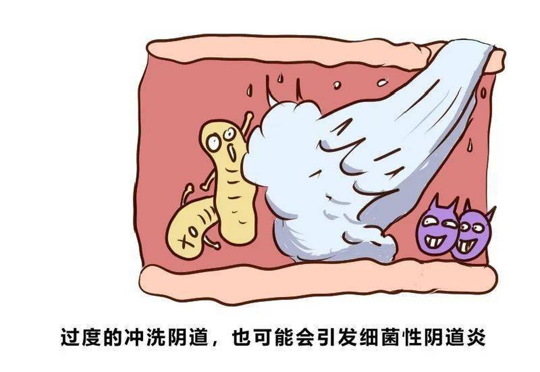 这些症状是细菌性阴道炎到来的"重要信号,别不当回事#阴道炎
