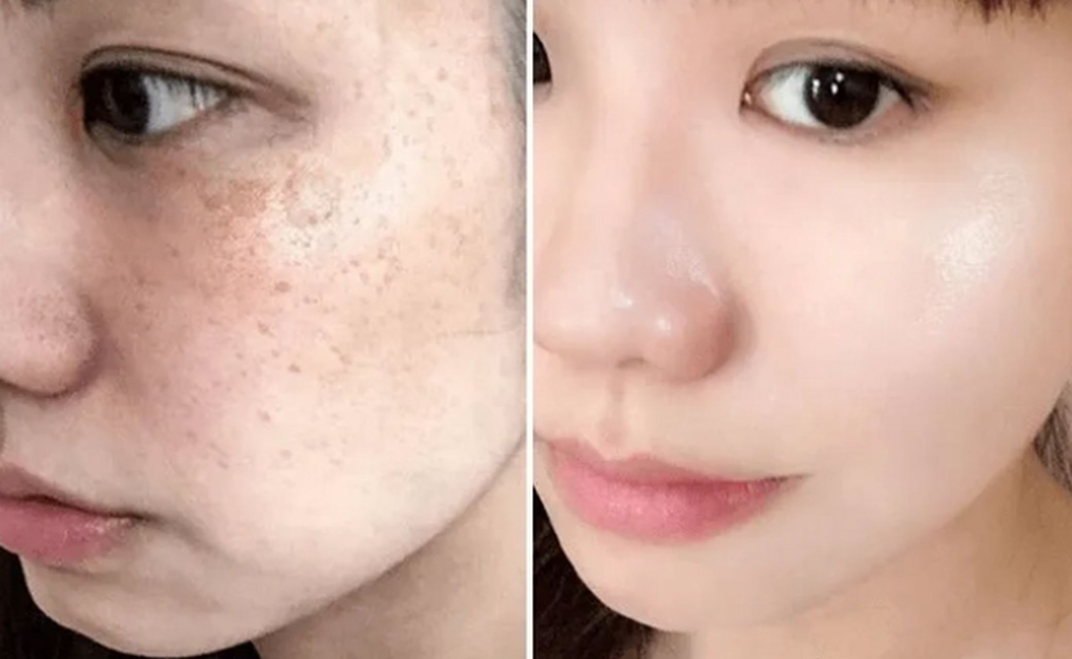 露卡菲娅祛斑套装# 淡斑精华哪个牌子效果好?