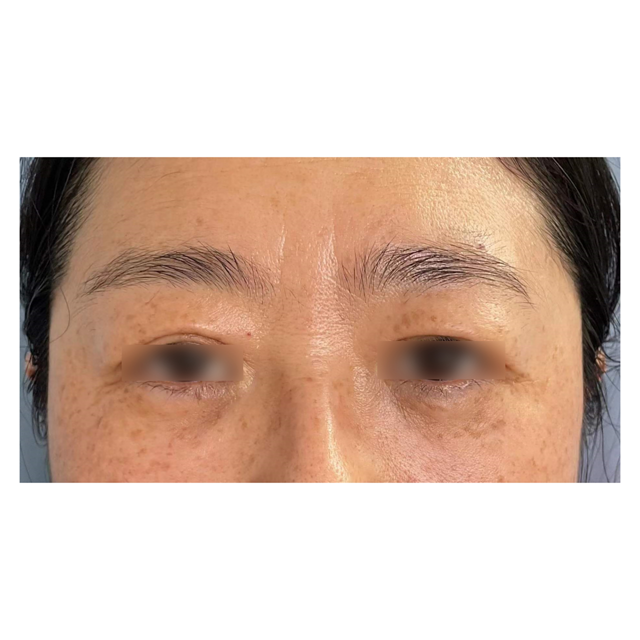 静态#川字纹# 发展历程: 早期印记较浅,中期印记加深开始凹陷,晚期