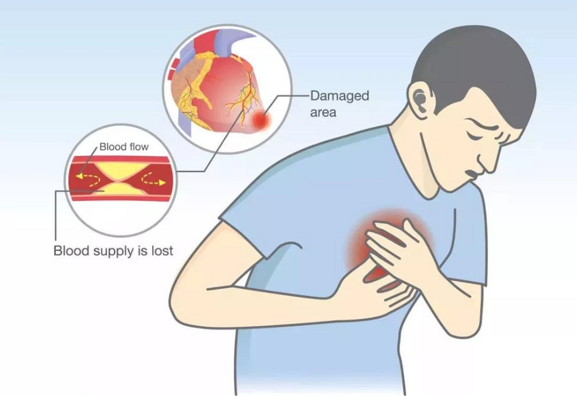 很多中老年人经常面临胸闷气短,呼吸困难的问题,尤其是稍微运动或劳动