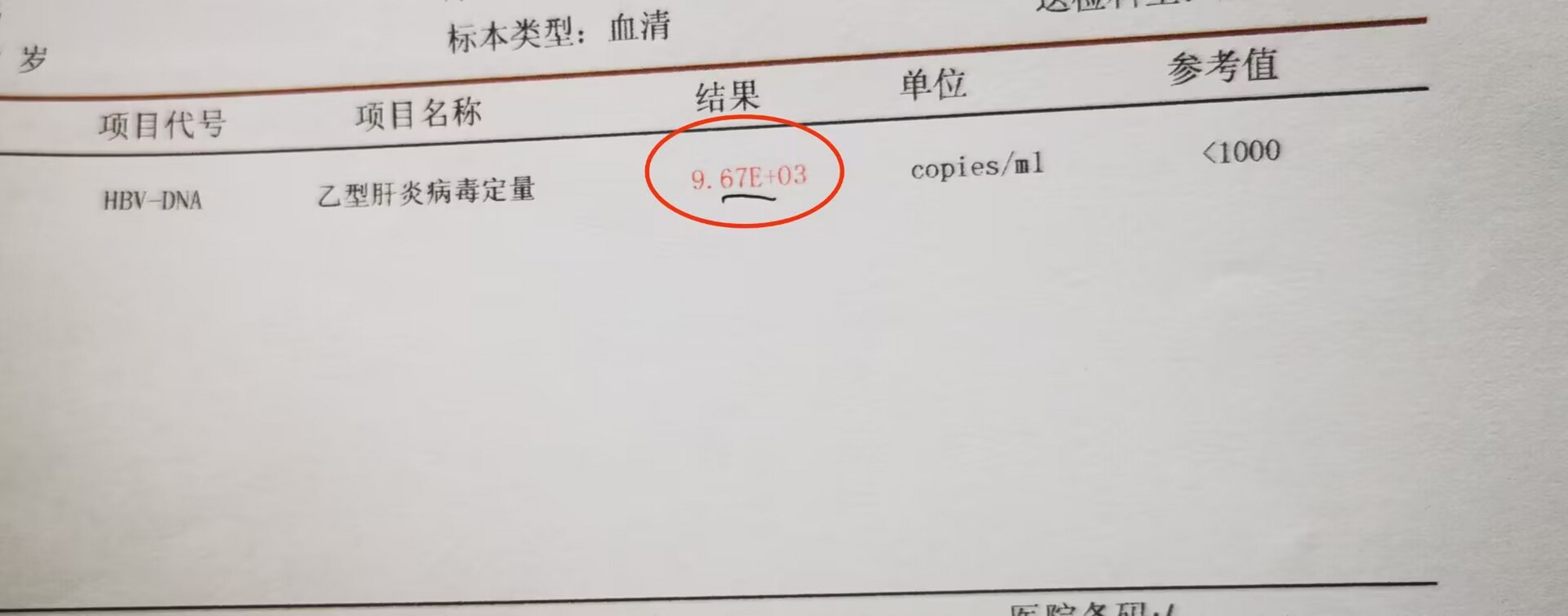 很多患者拿到乙肝病毒定量检验单后,一头雾水不知道检查结果具体代表