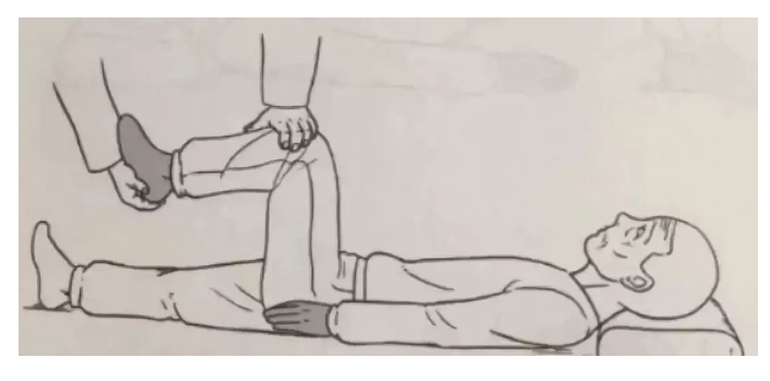 脑中风偏瘫后,偏瘫患者下肢抗痉挛方法(足部被动运动) #脑梗偏瘫正确