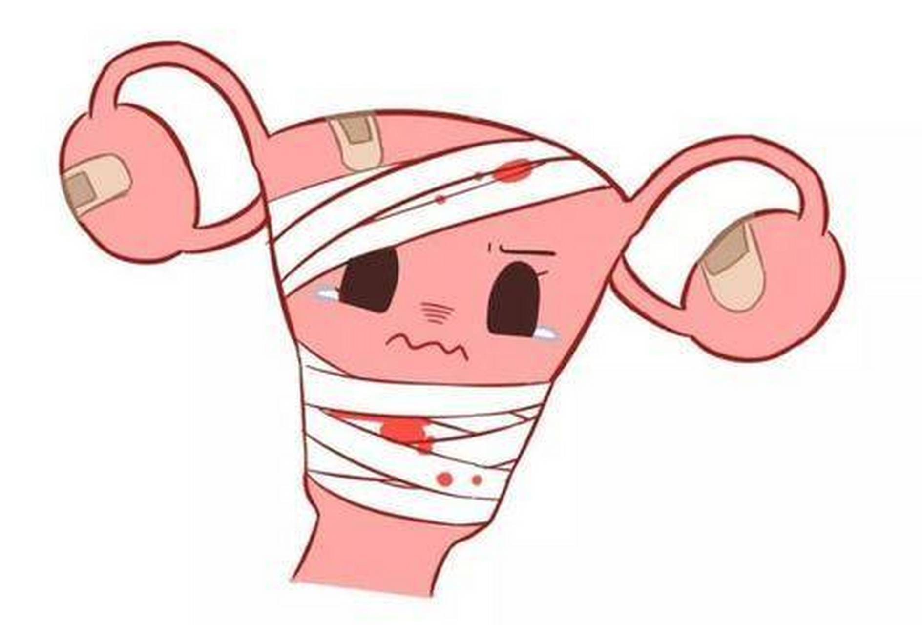 宫颈有癌,大腿会出现3个异常!