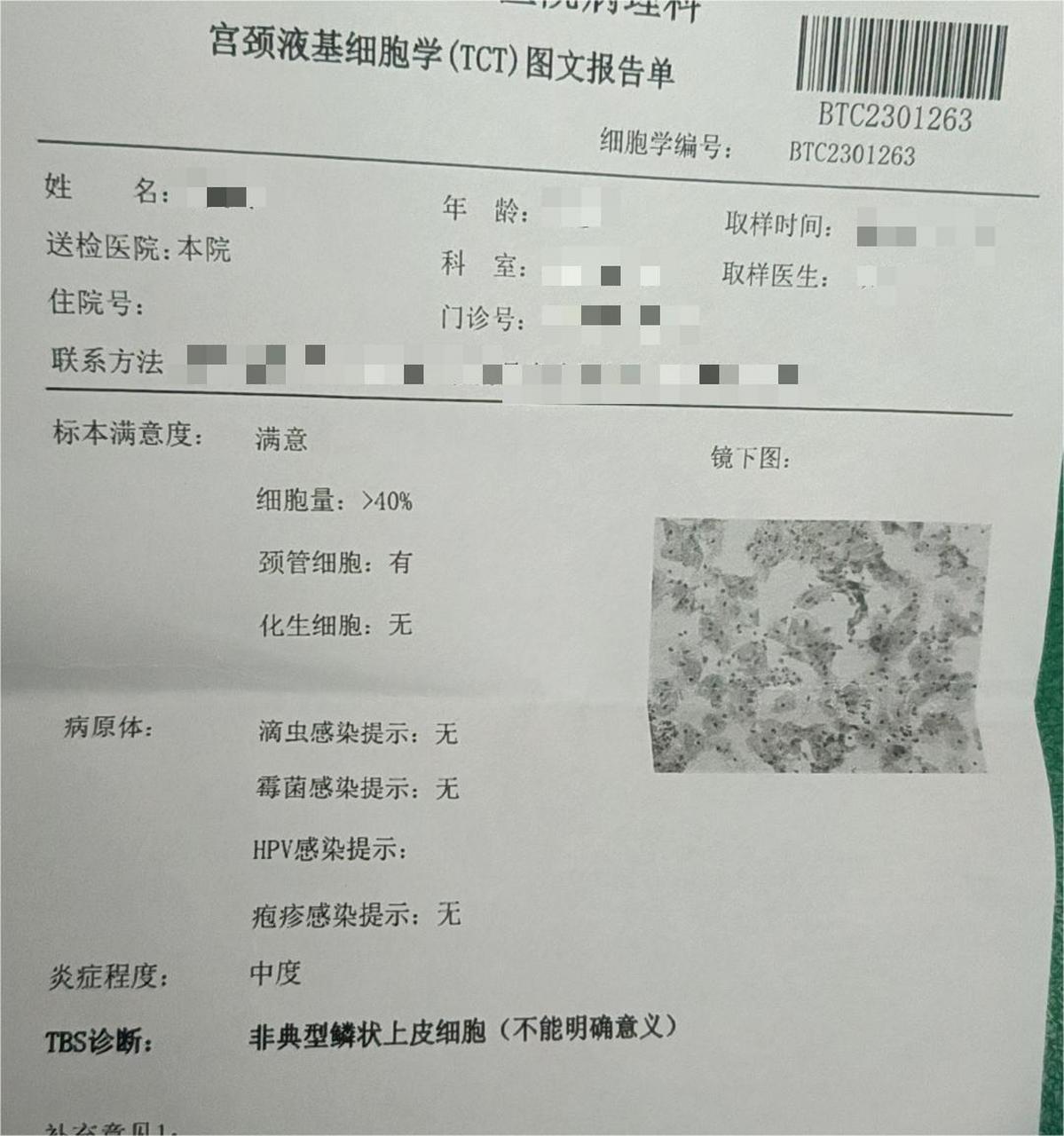 产后为什么要做tct