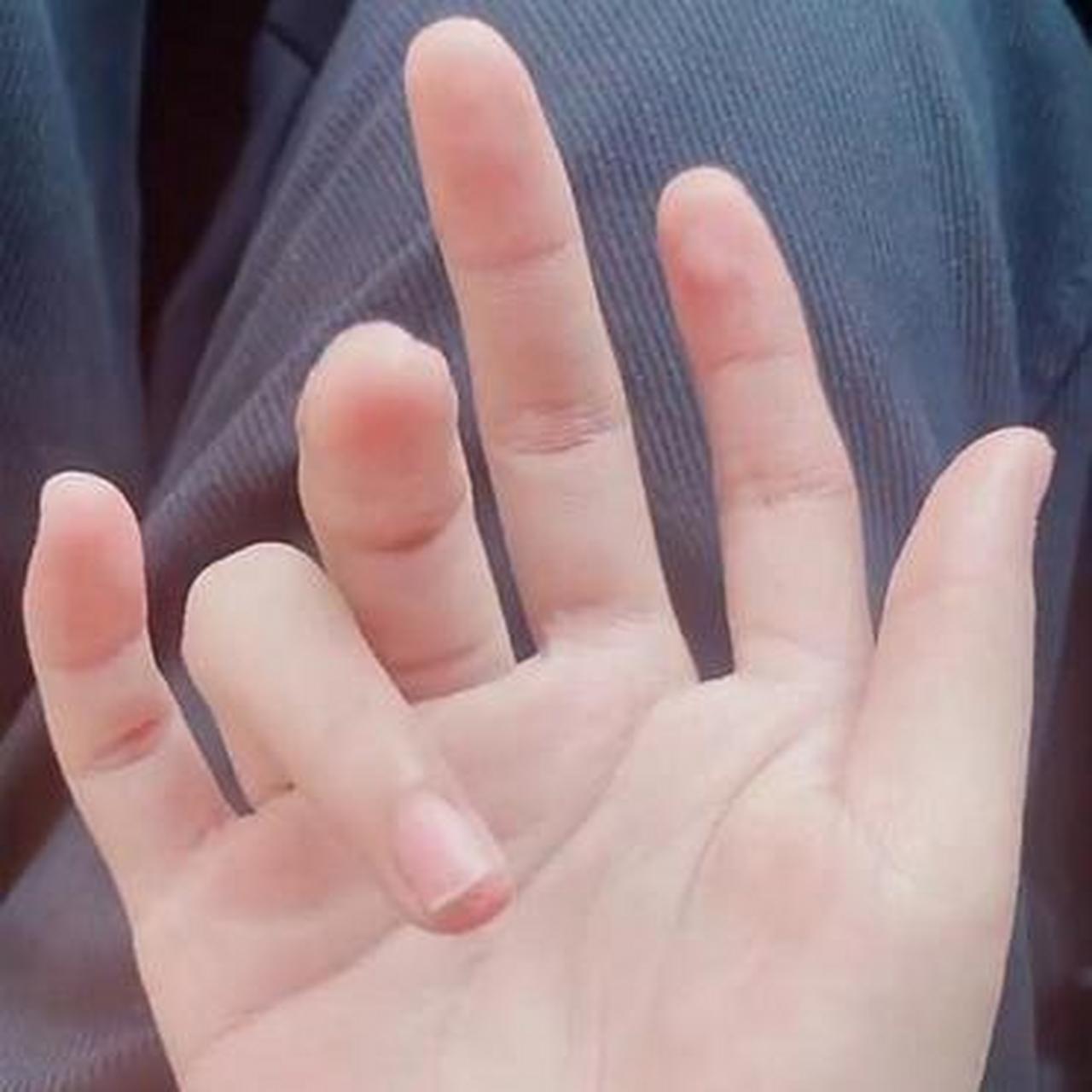 原来六个手指头也这么好看呀,就是不好买手套吧?