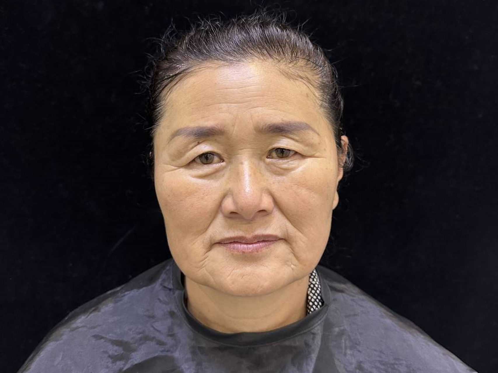 随着年龄的增长,皮肤逐渐松弛,导致眉毛下垂,给人一种憔悴的印象.