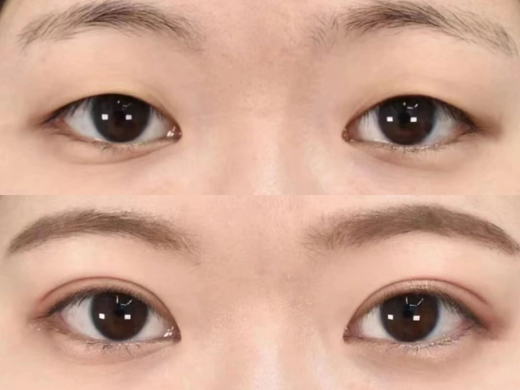 全切双眼皮4个月以后,双眼皮恢复非常自然了,这个姑娘做的7mm的扇形