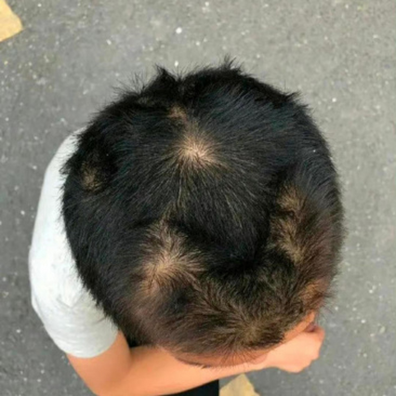 看这孩子头顶,将来必成大器!