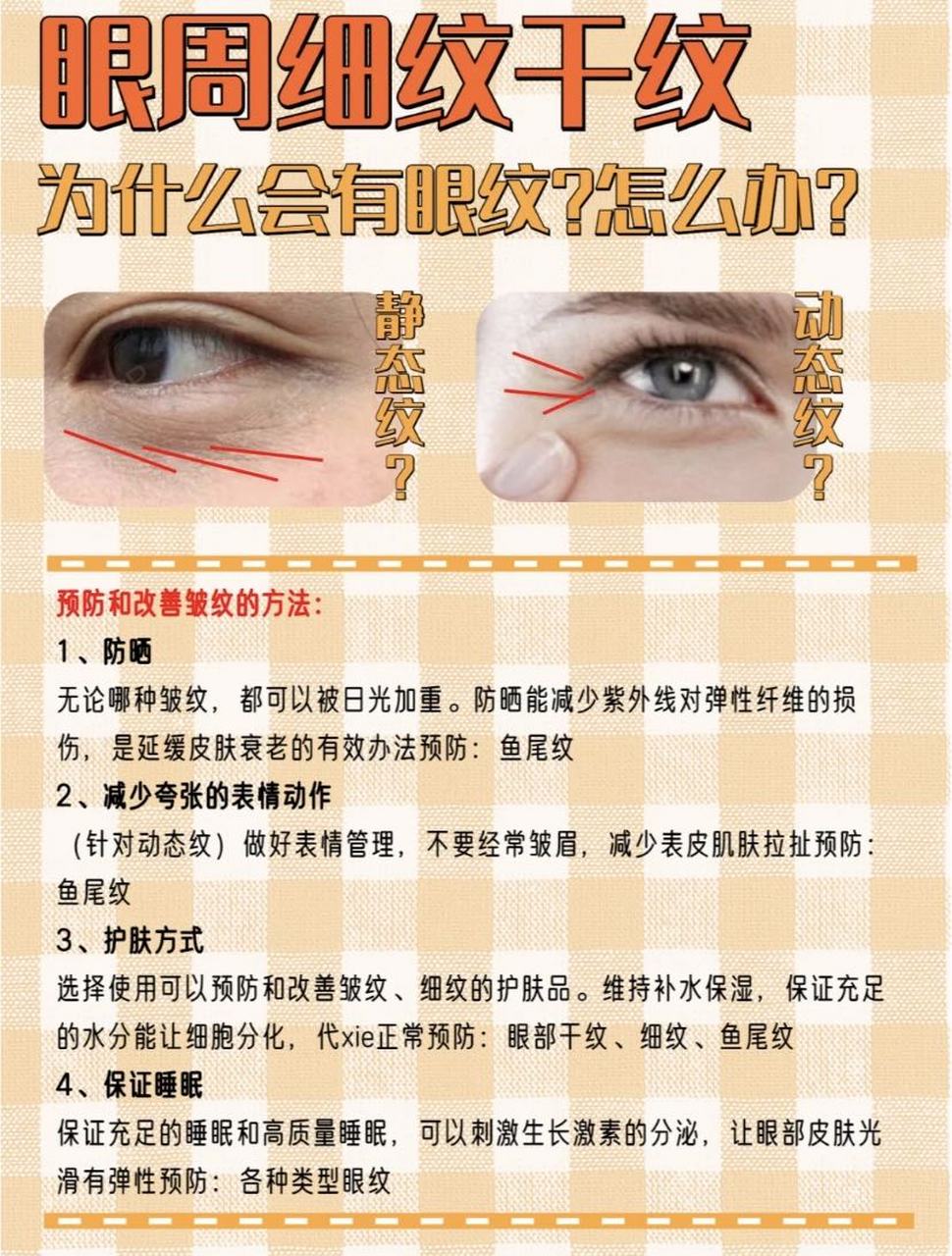 眼周细纹干纹!是怎么产生的?有了怎么办?
