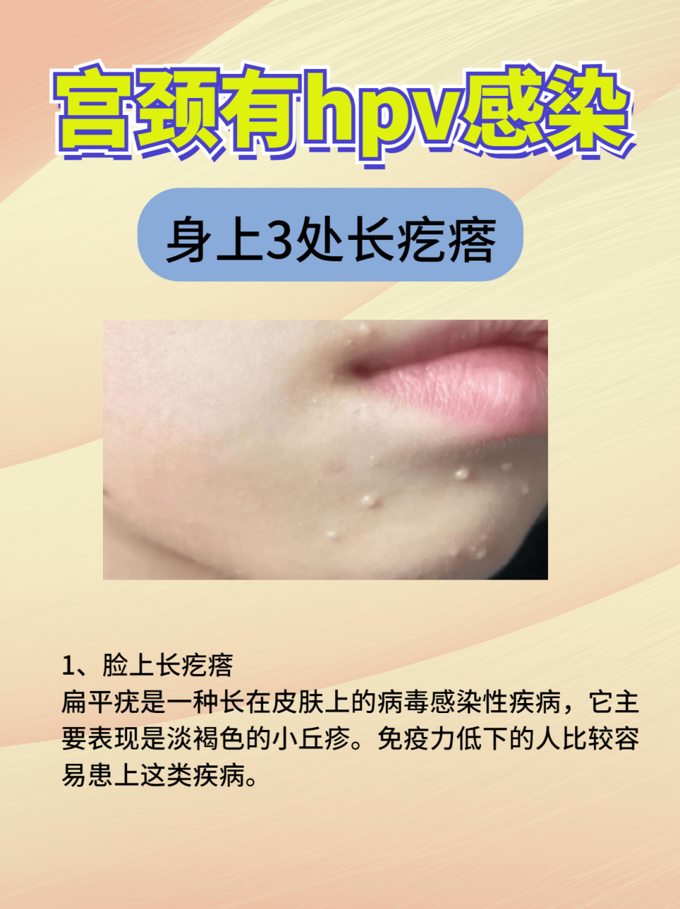女人发现身上3处长疙瘩,不是简单的皮肤病,警惕hpv上门,别再拖了