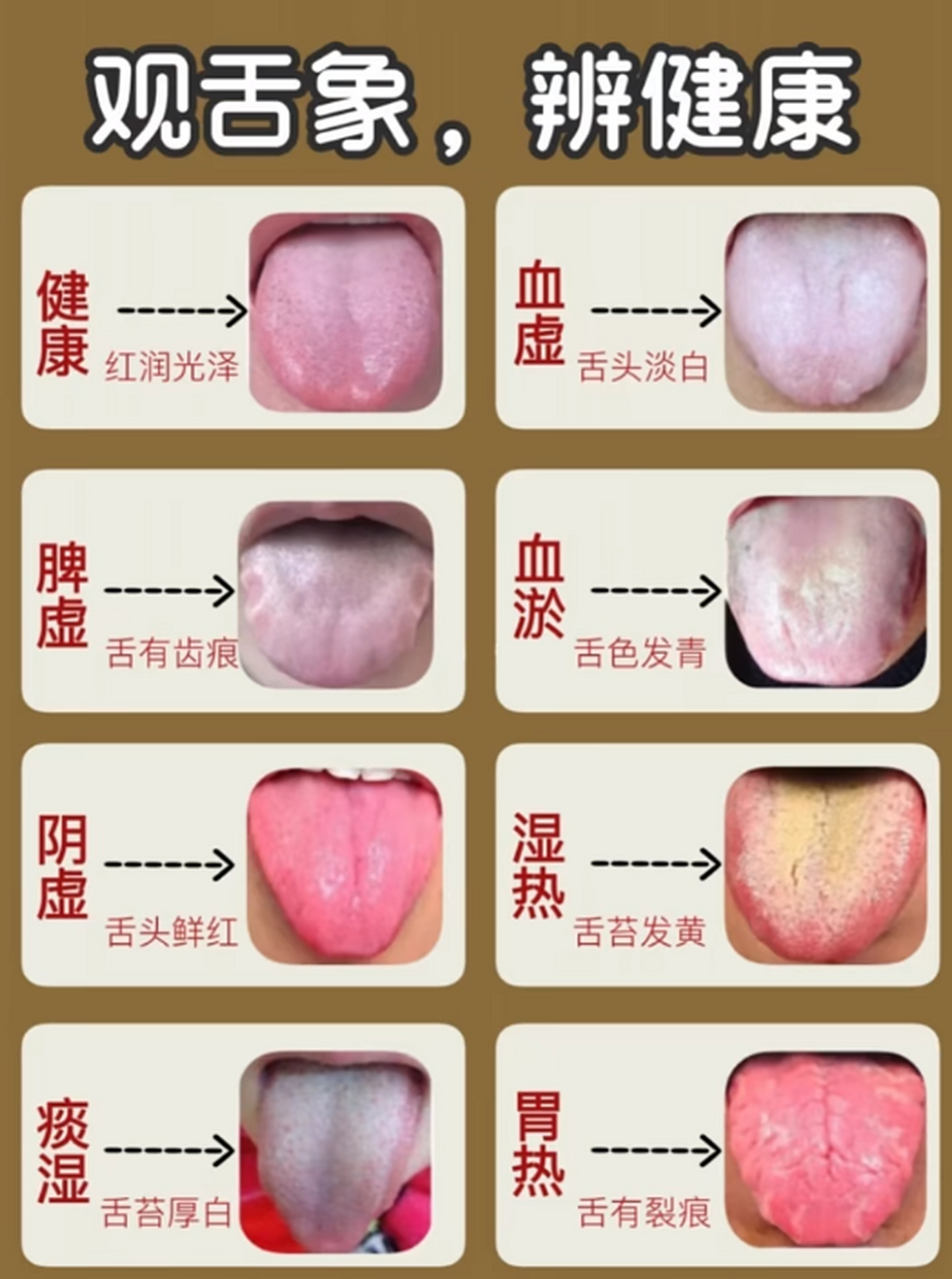 中医辨别舌苔图片图片