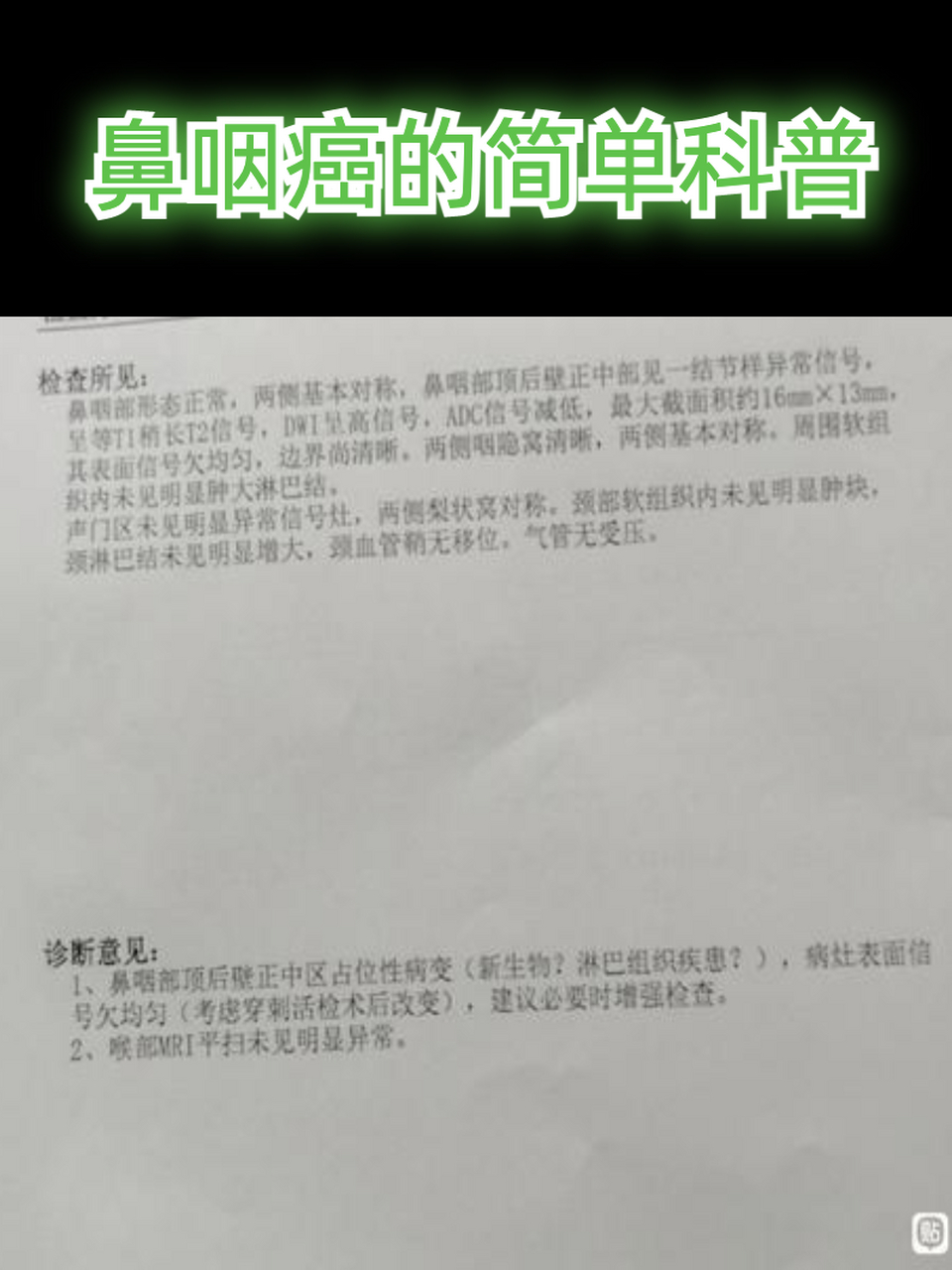 鼻咽癌简单科普 1 (内容是经东肿内镜科倪晓光主任的同意,通过倪主任
