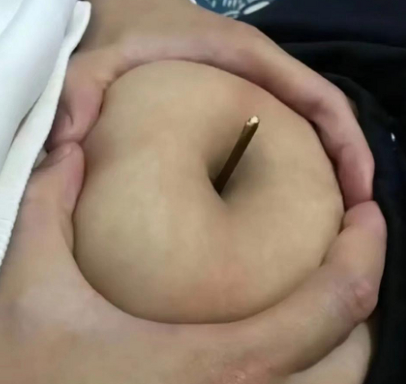 这是肚子还是苹果?