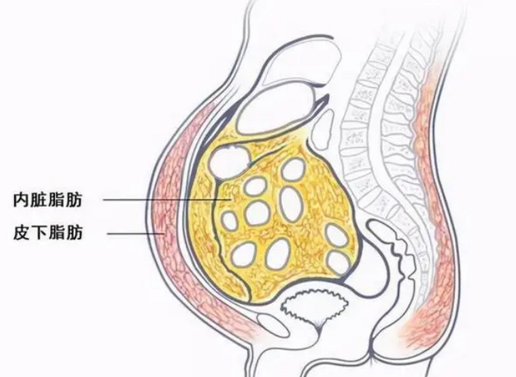 四肢不胖肚子大,内脏脂肪超标怎么办?