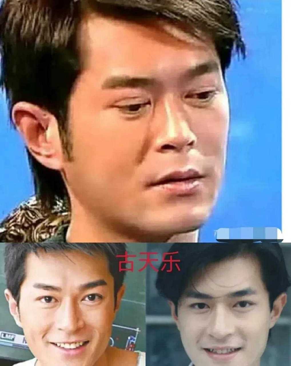 割过双眼皮的男明星图片