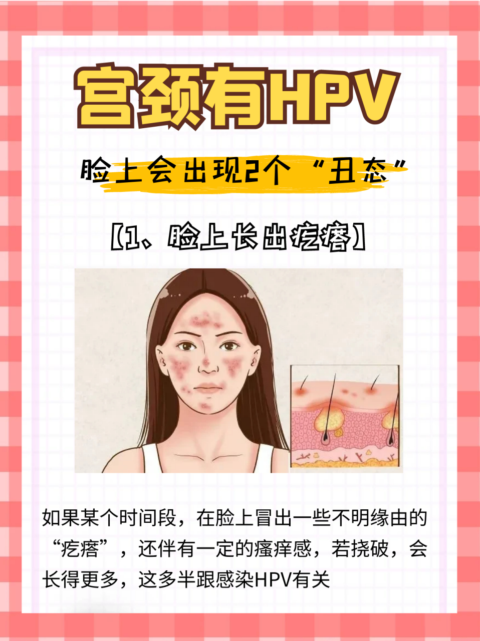 宫颈有hpv,看脸就知道,2个"丑态"容易被发现,可以照镜自察