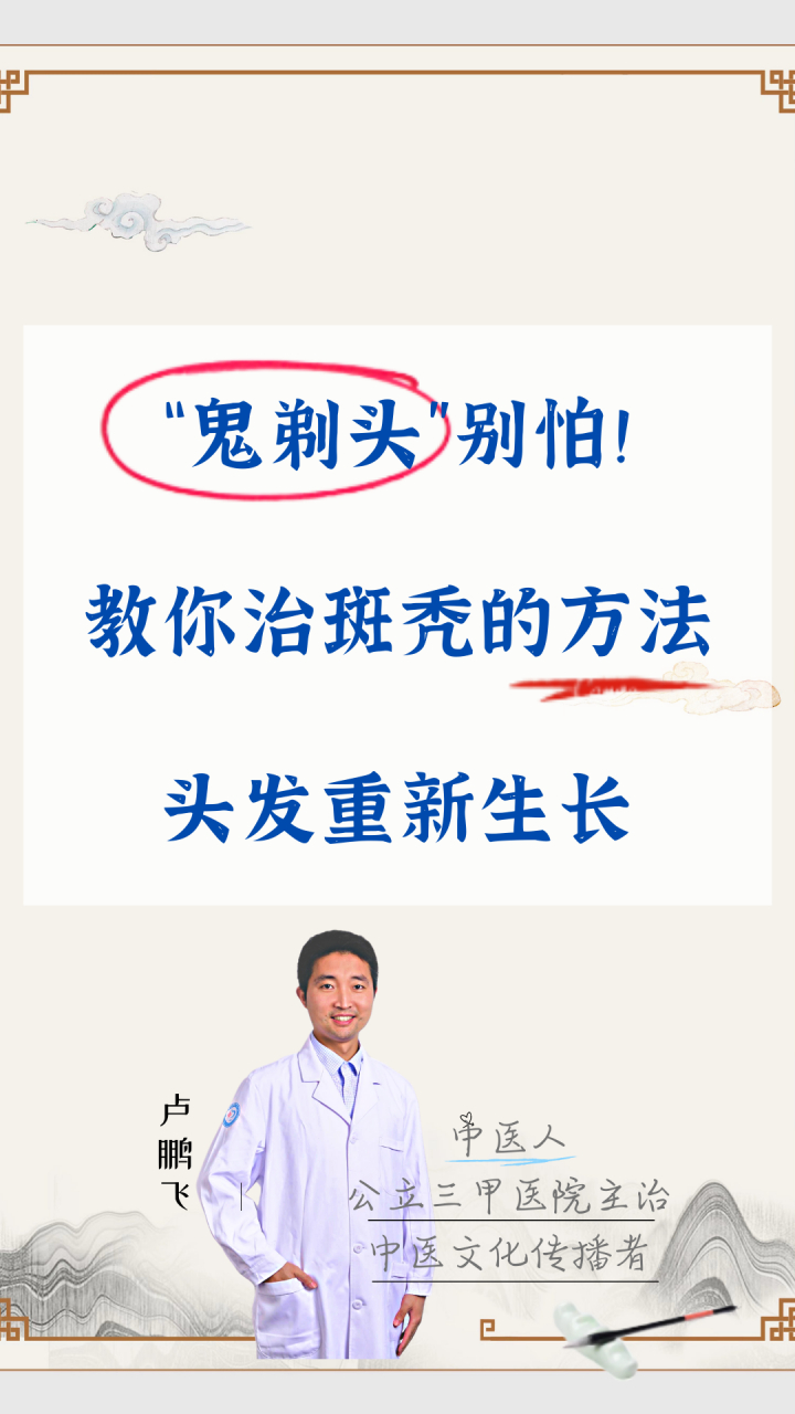 "鬼剃头"别怕! 教你治斑秃的方法,头发重新生长