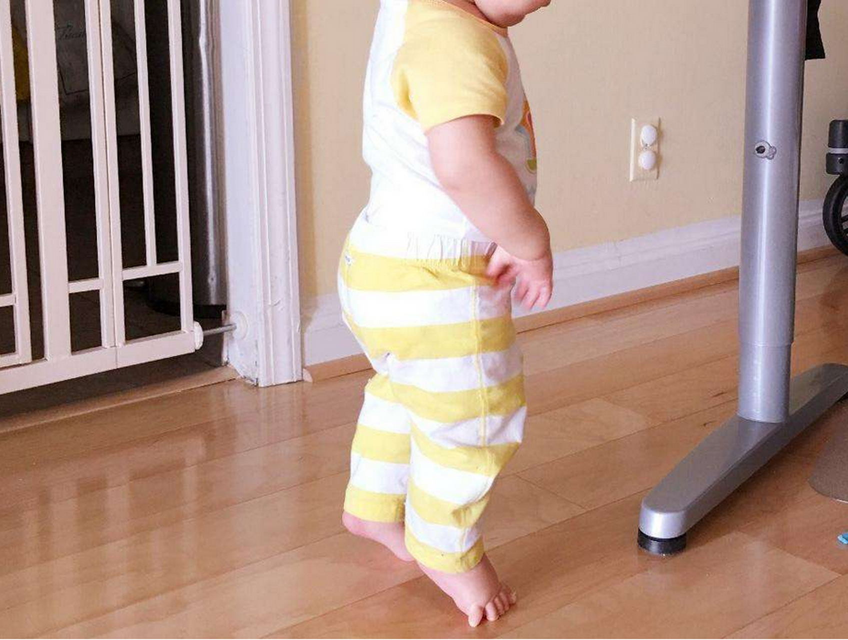 家长发现孩子有尖足时,如何区分正常还是异常?