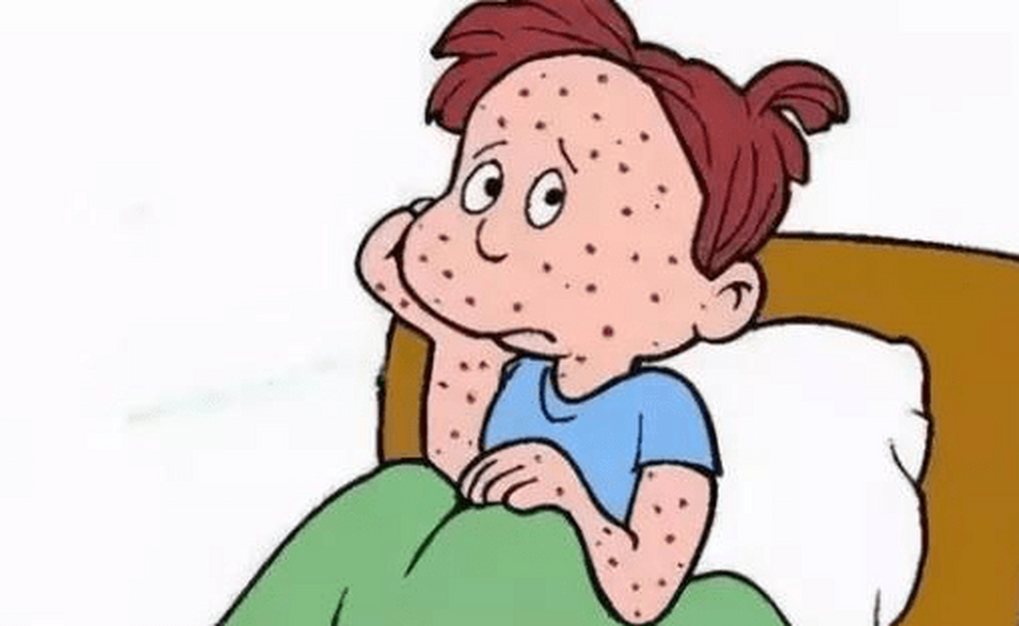 过敏性紫癜是一种较常见的微血管变态反应性出血性疾病,病情的轻微