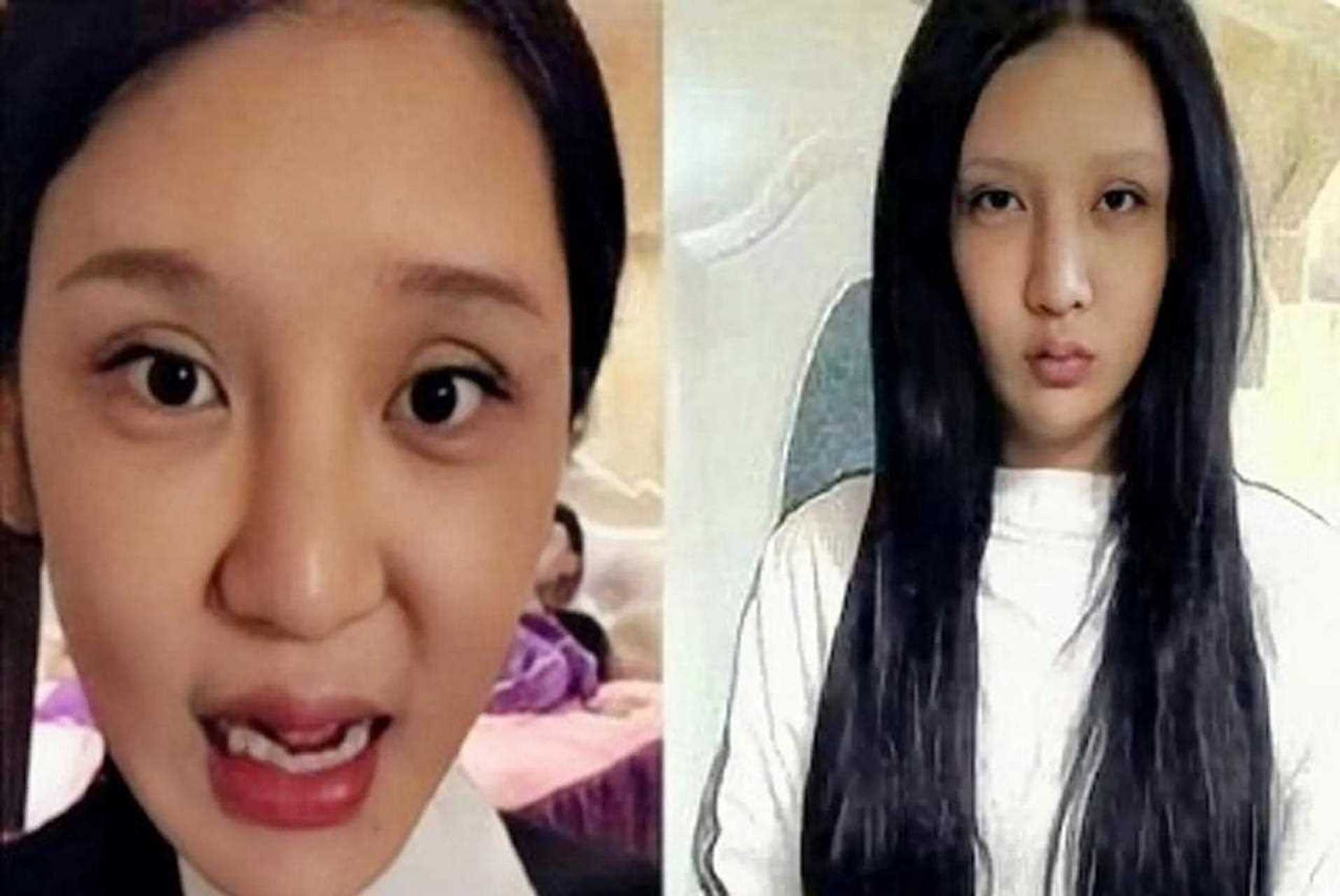 花费上百万,整容上百次,红粉宝宝所付出的不仅是金钱,更是自