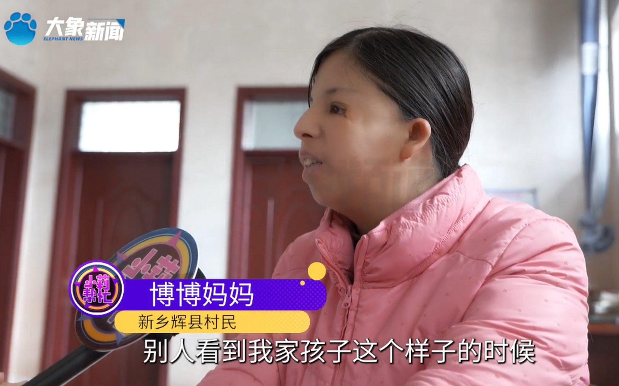 男孩患"鸟面综合症",脸部看起来像鸟,妈妈:小孩看到他都害怕