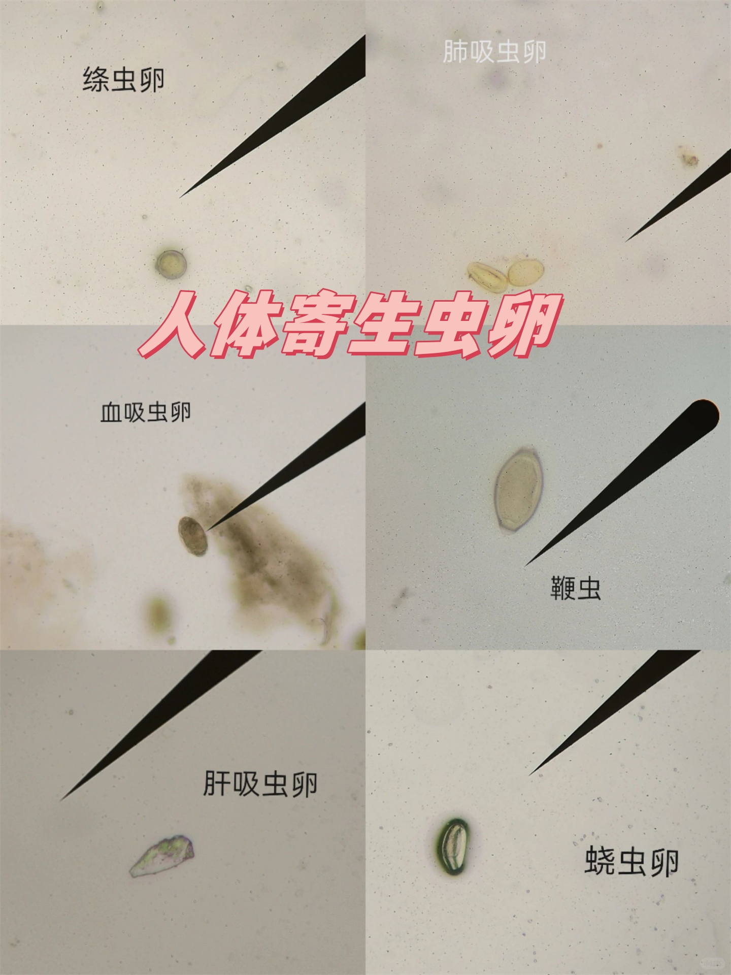 人体寄生虫卵