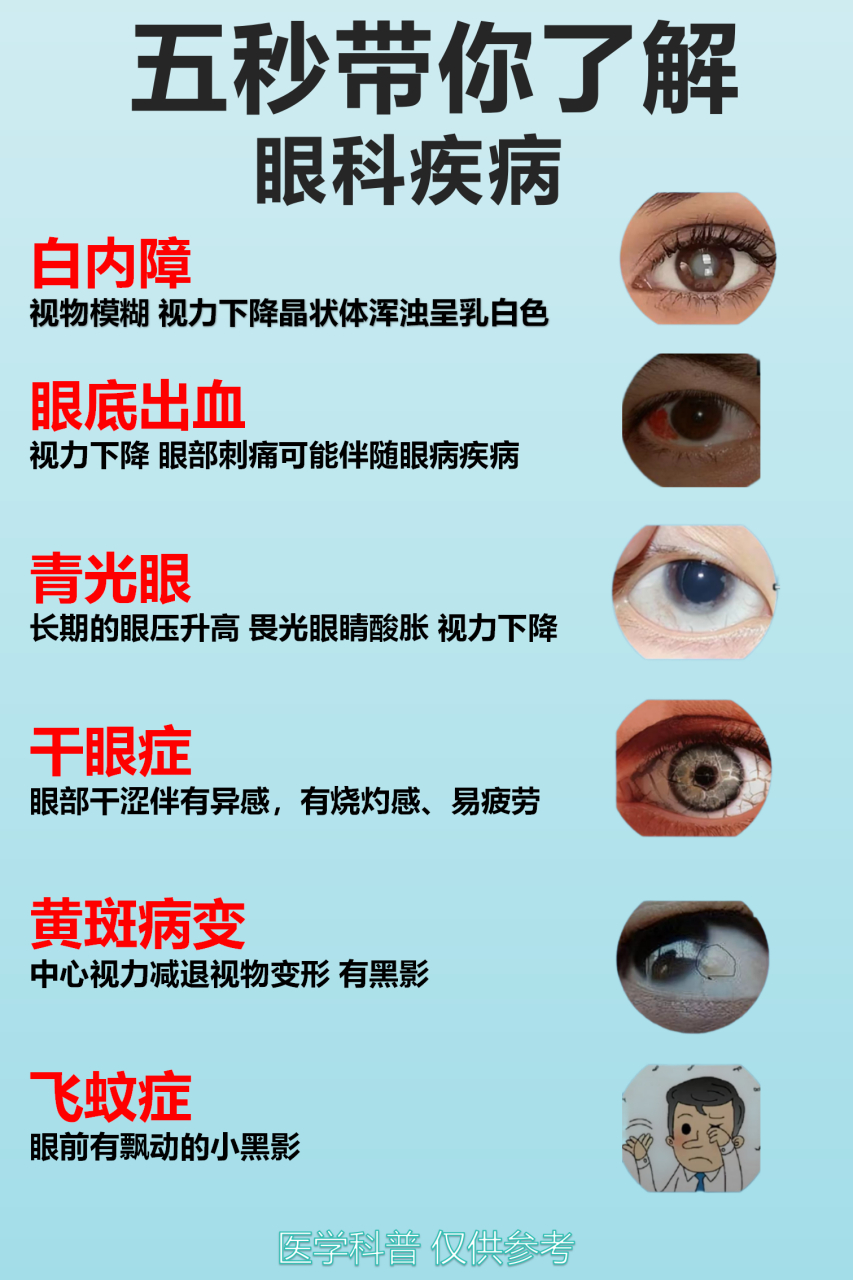 跟大家介绍几种常见眼病 眼睛在我们生活中作用非常的