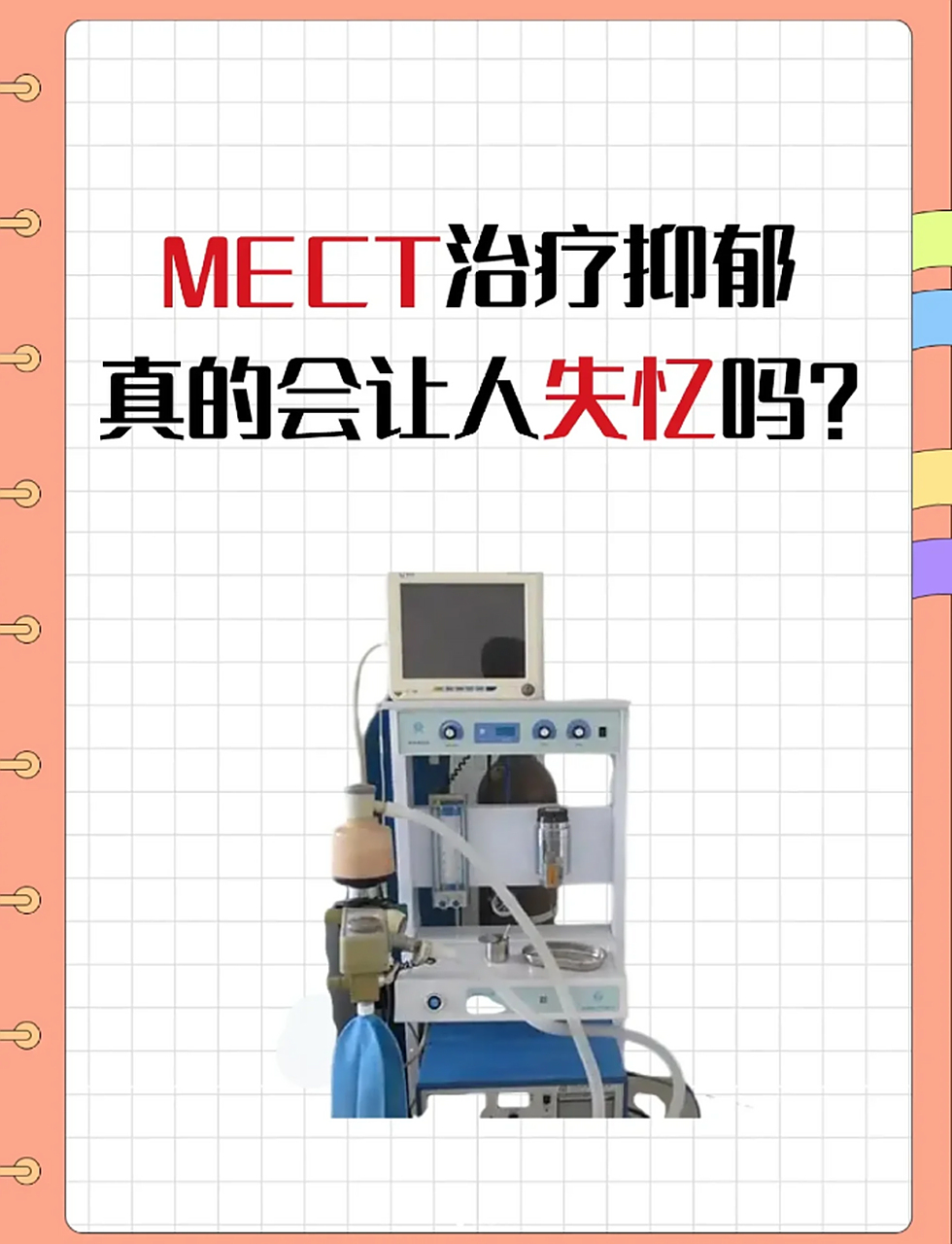 mect治疗抑郁症会让人失忆吗? #mect治疗# #抑郁症# #对抗抑郁症