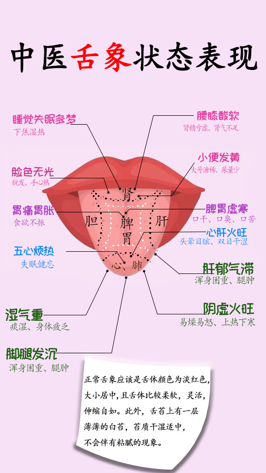 看舌象知健康|跟着中医学舌诊,赶快自测  中医认为