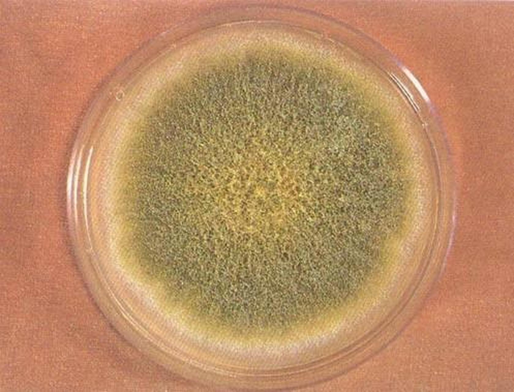 身边的超级致癌物黄曲霉菌#  你可能听说过黄曲霉素,它是一种毒性极