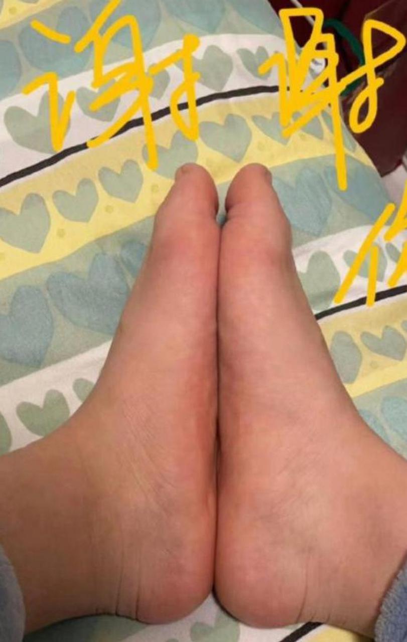 长这么大了才发现我也是扁平足,这脚为什么不能当兵啊?