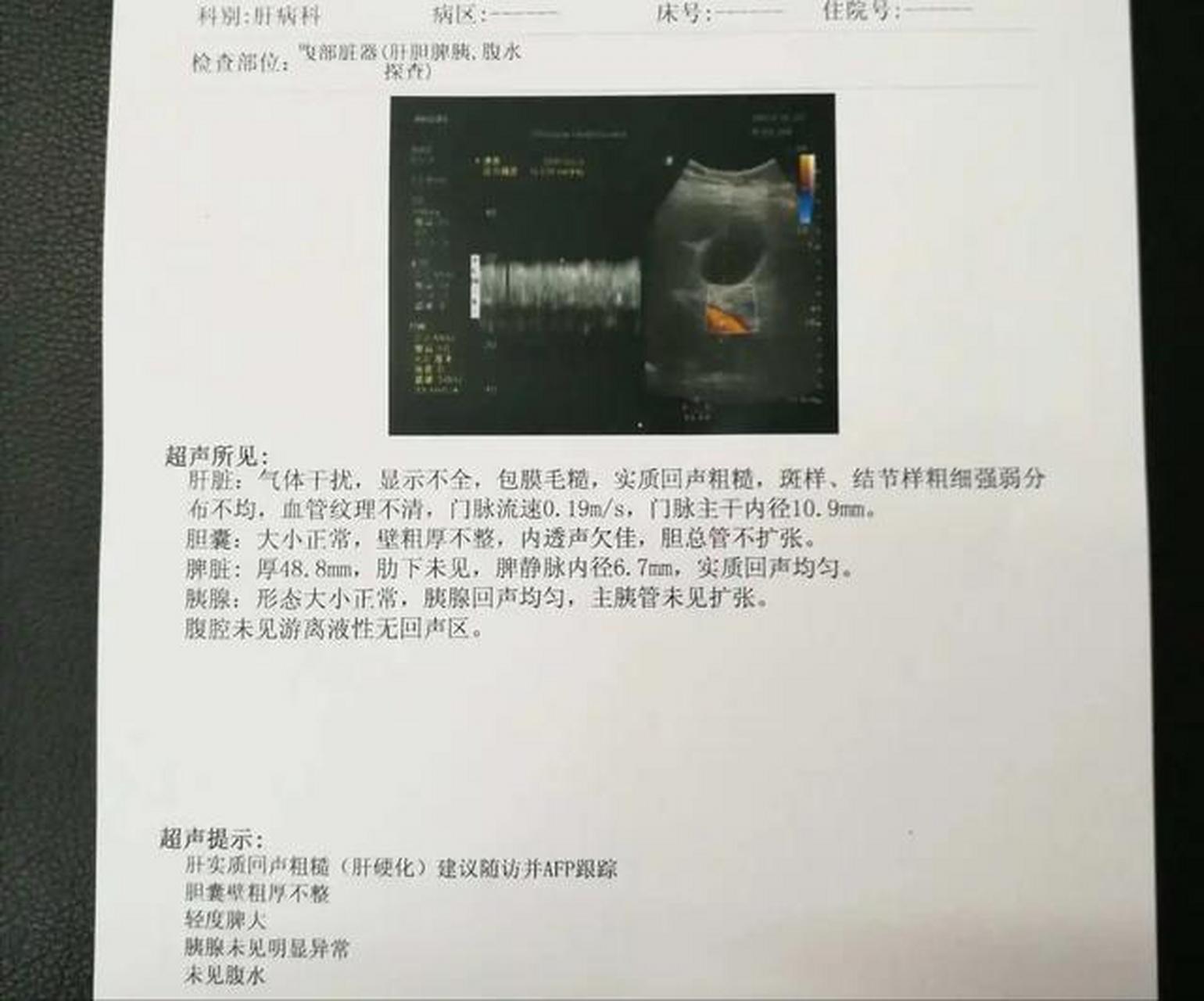 肝脏彩超 对于诊断肝硬化和肝硬化的分期有一定意义,联合甲胎蛋白